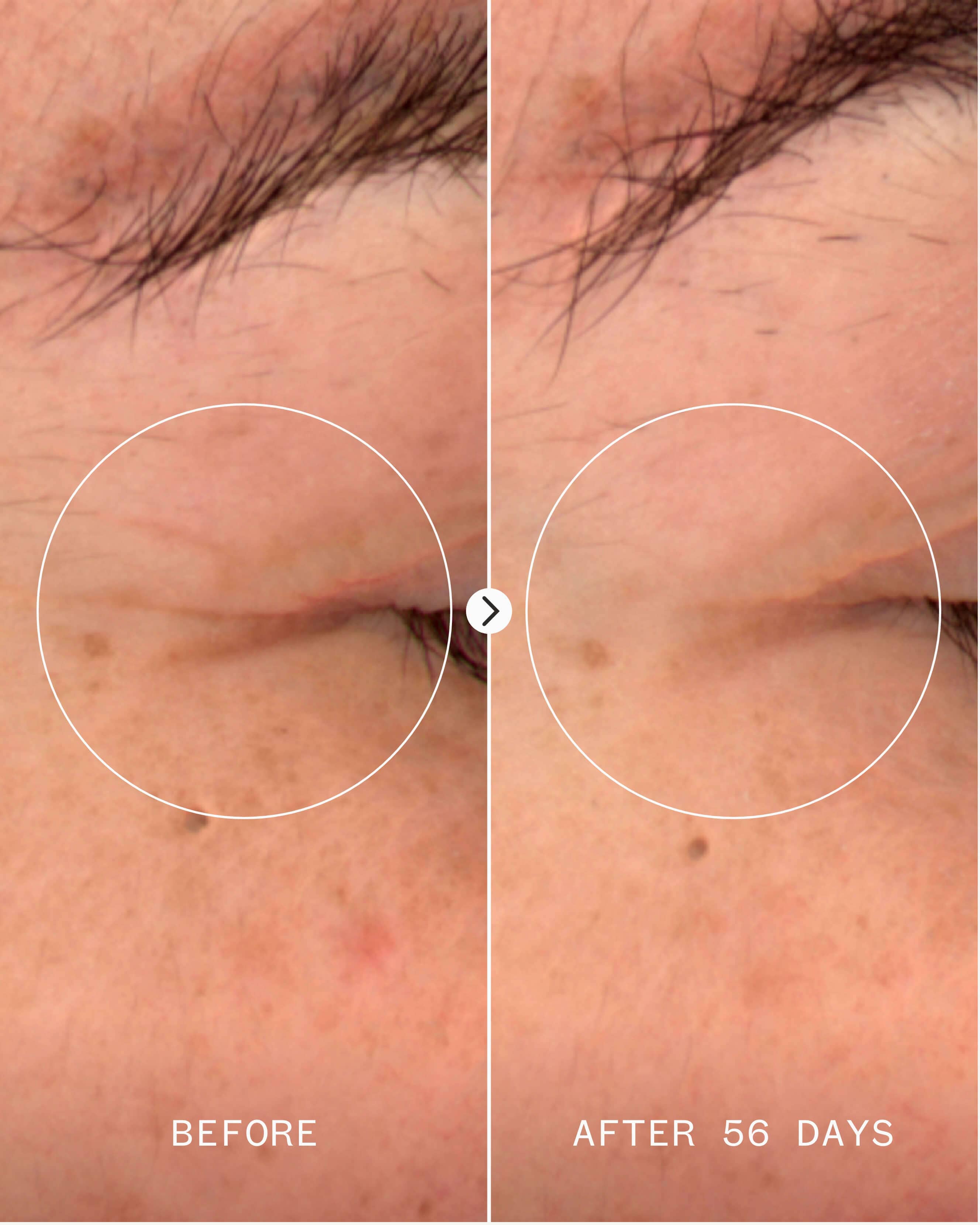 Age Confidence™ NAD+ & TriPeptide Renewal Serum 3