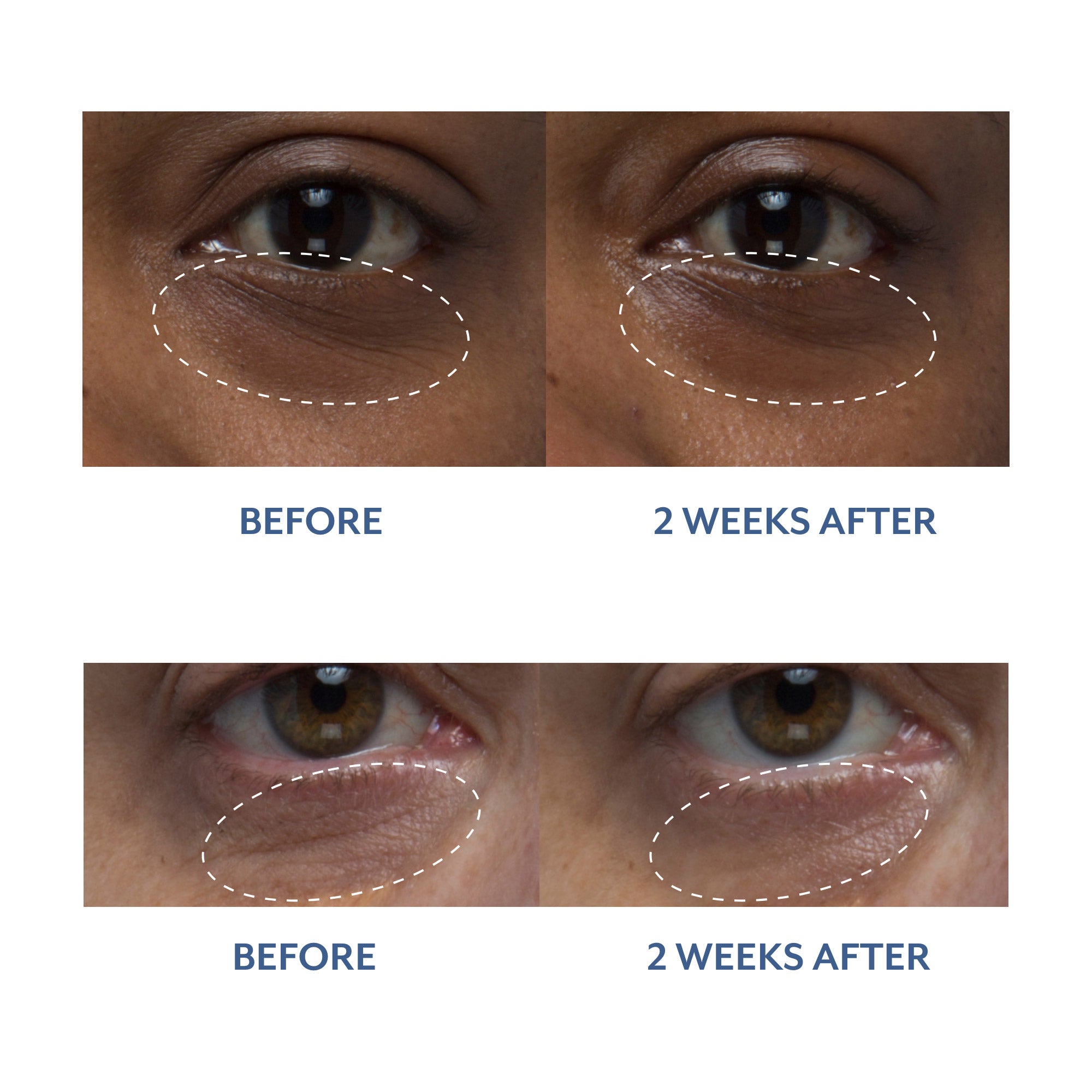 Black Tulip Eye Treatment 3