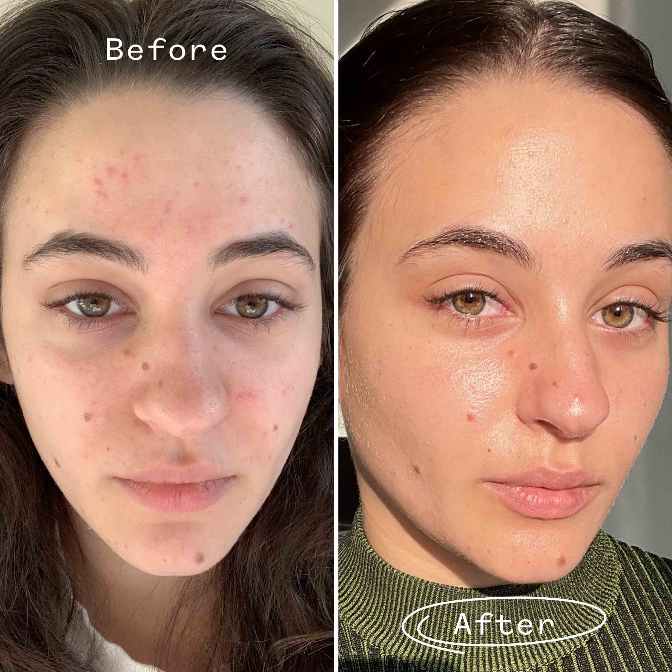Carbon Star™ Face Oil Mini 2
