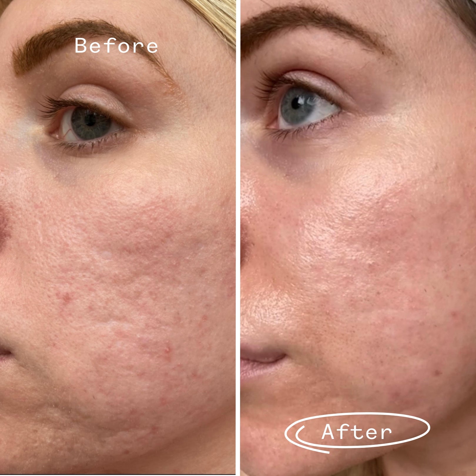 Hyaluronic Acid 0.3% Hydrating Booster 1