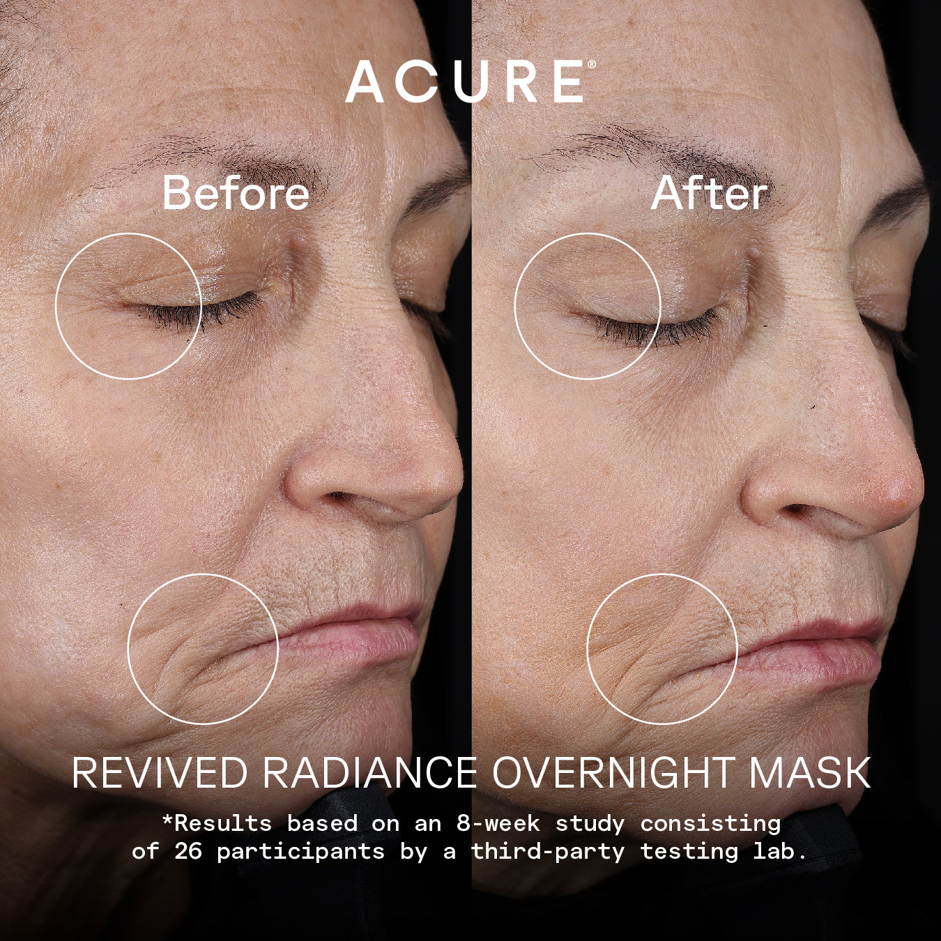 Overnight Renewal Duo 4