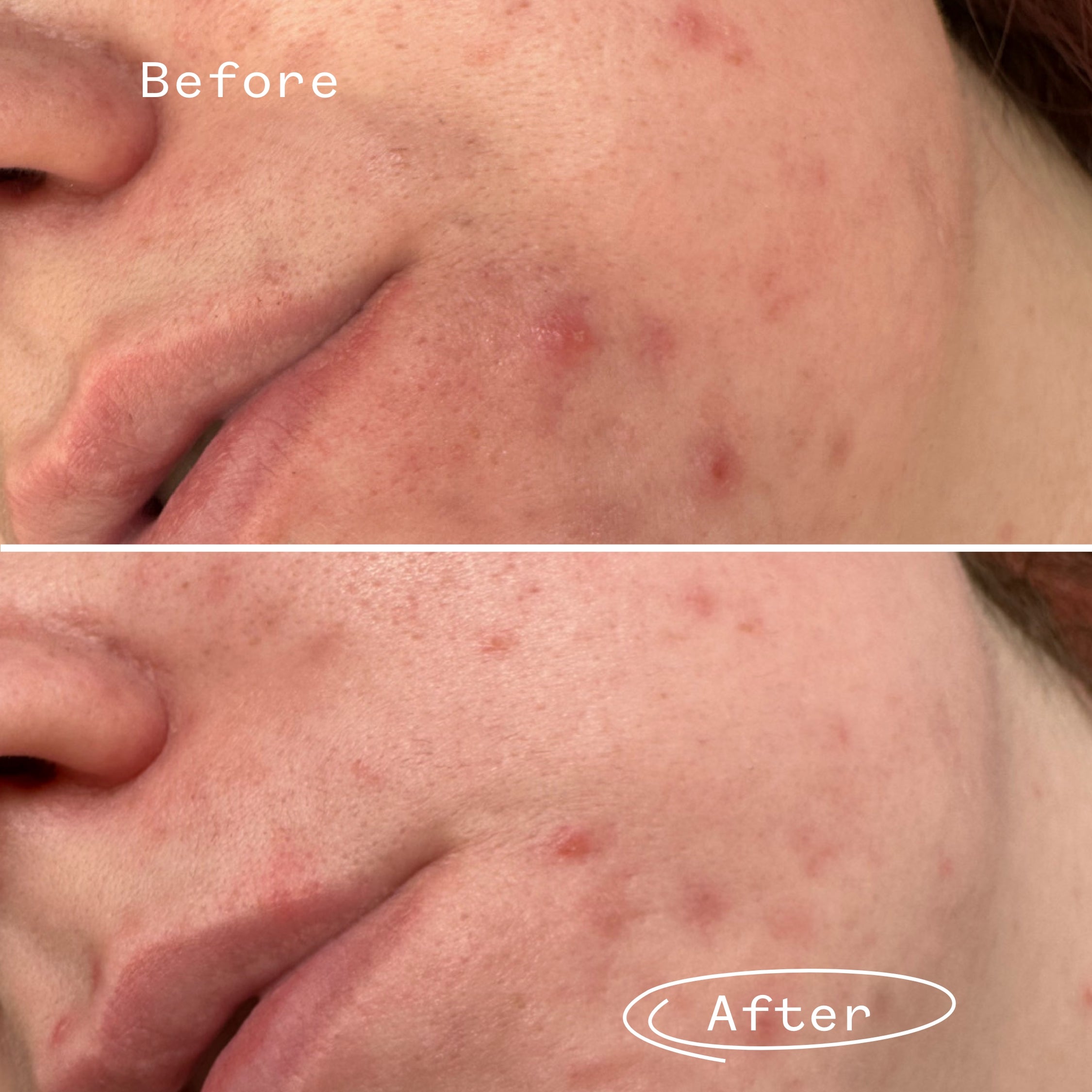 Phaze™ Gel Cleanser 2