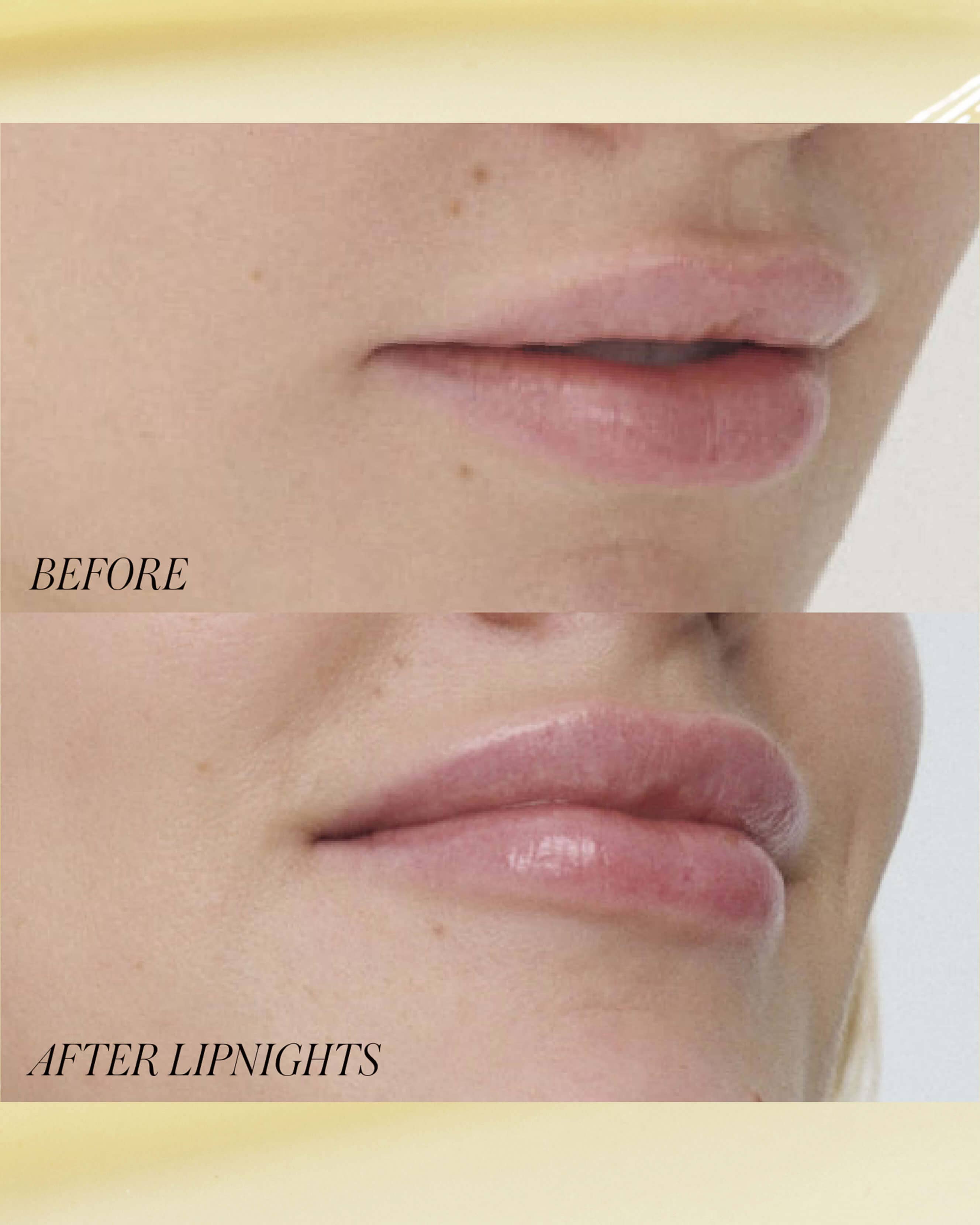 Lipnights Overnight Lip Mask 4