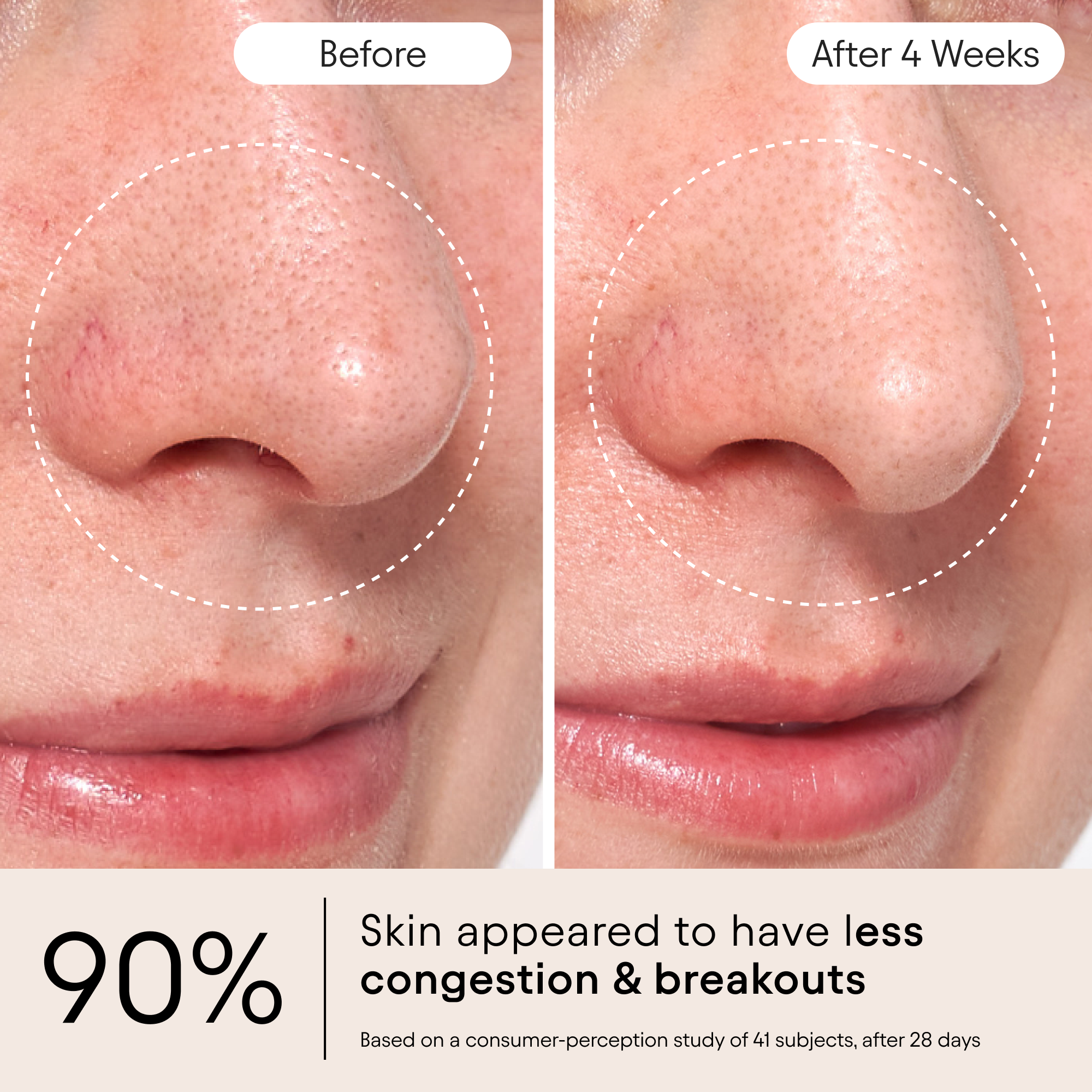 Clarifying Facial Oil 4