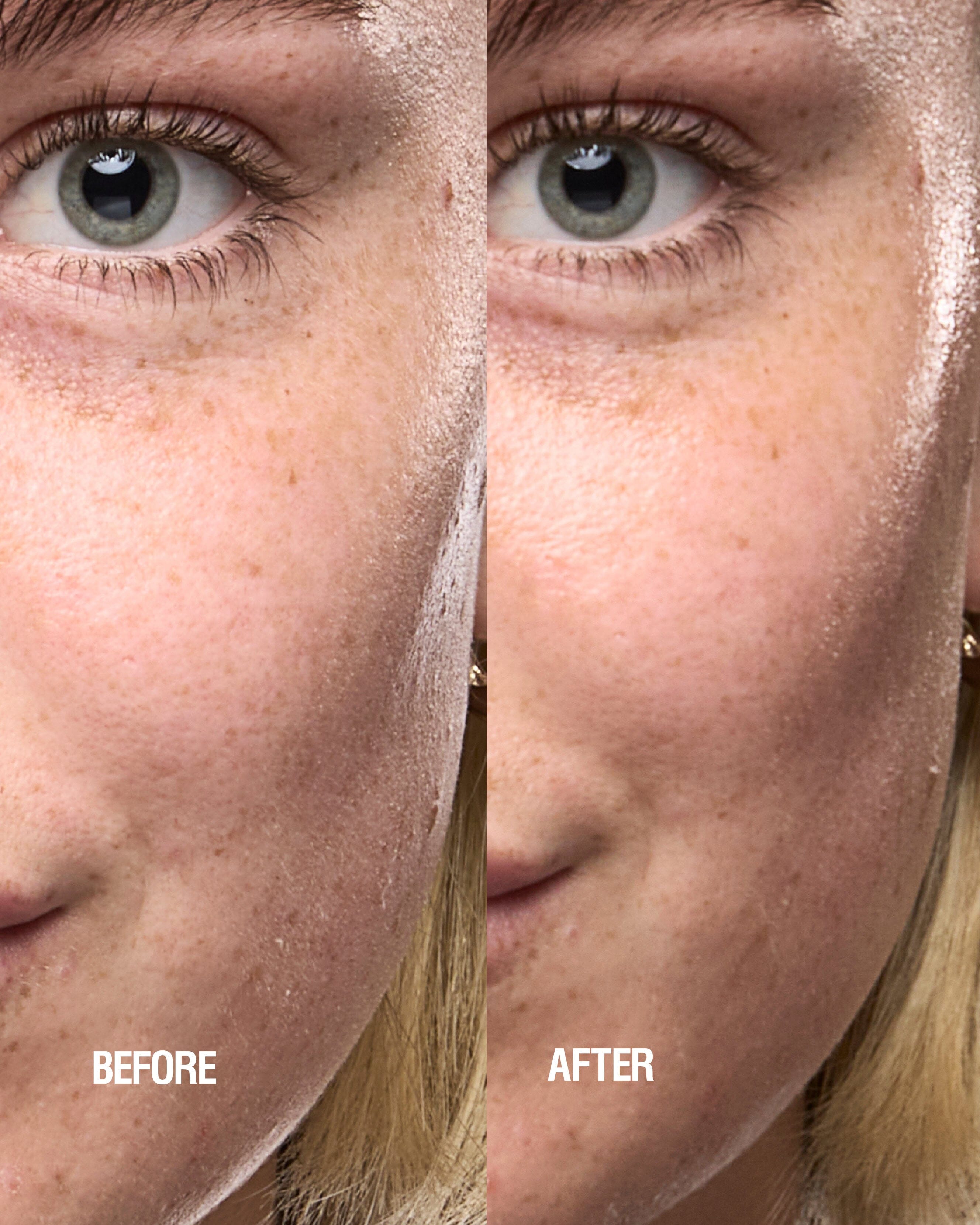 Skin Renewal Serum 4