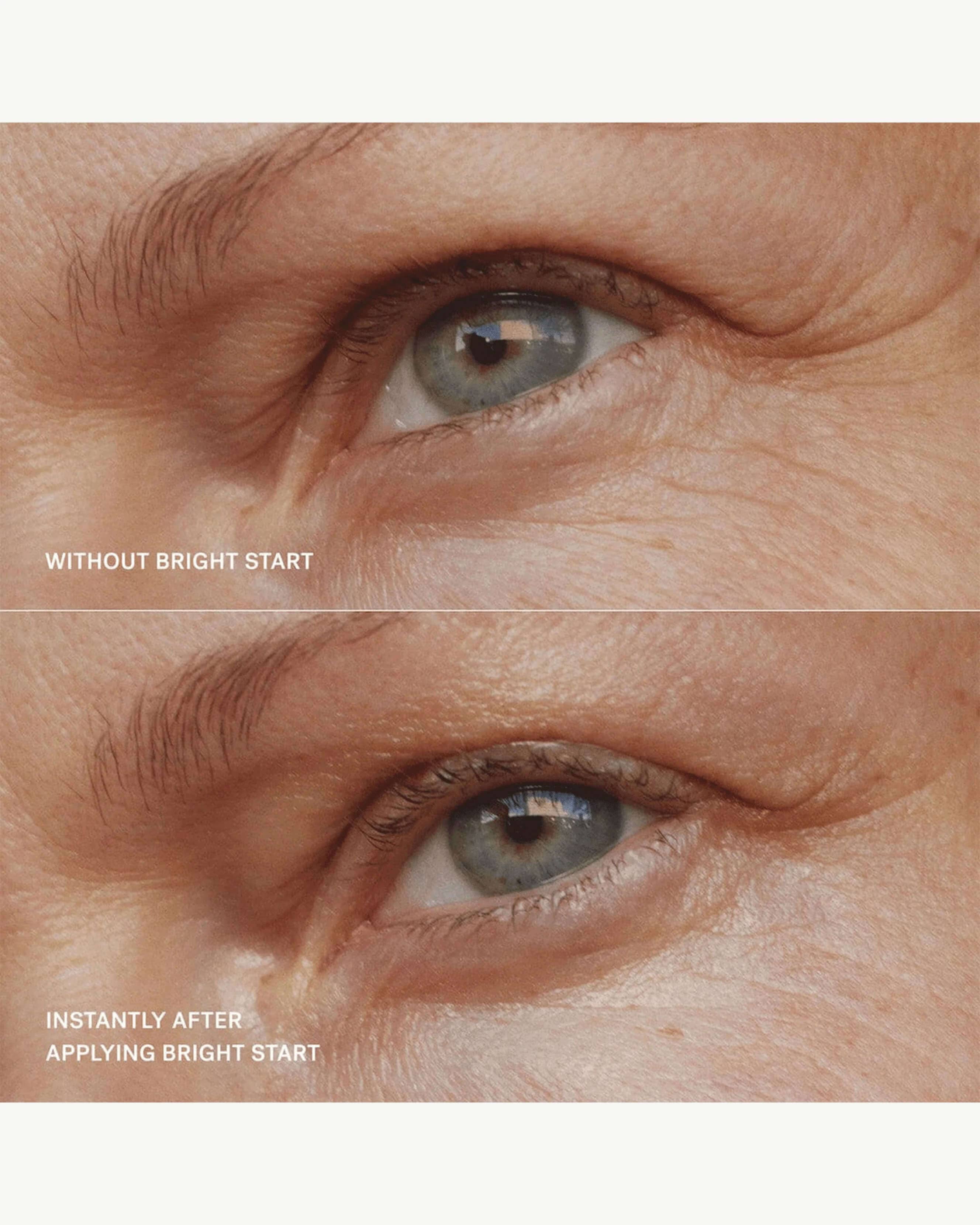 Bright Start Retinol Alternative Eye Cream 13