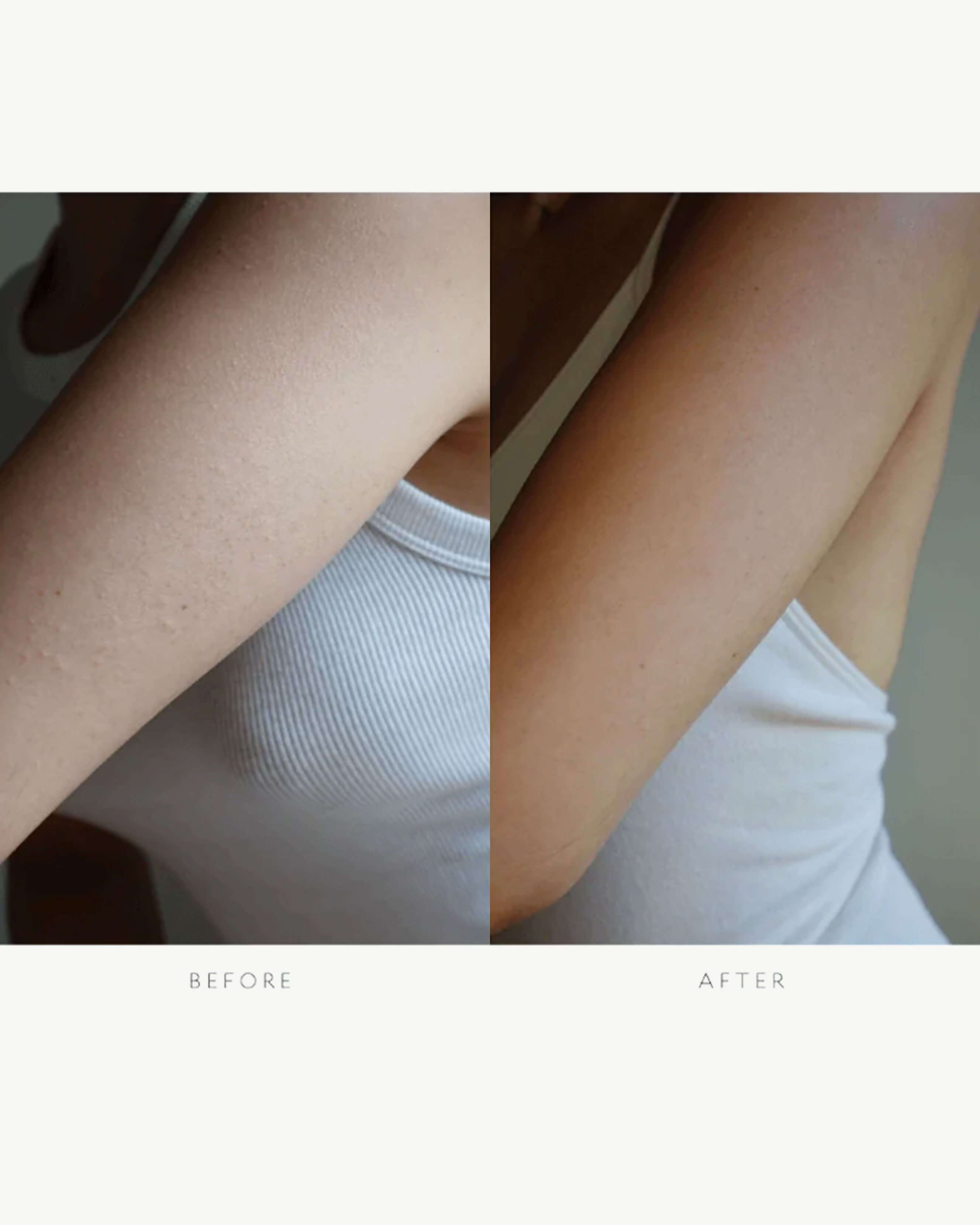 Resurfacing Body Serum - 25ml 5