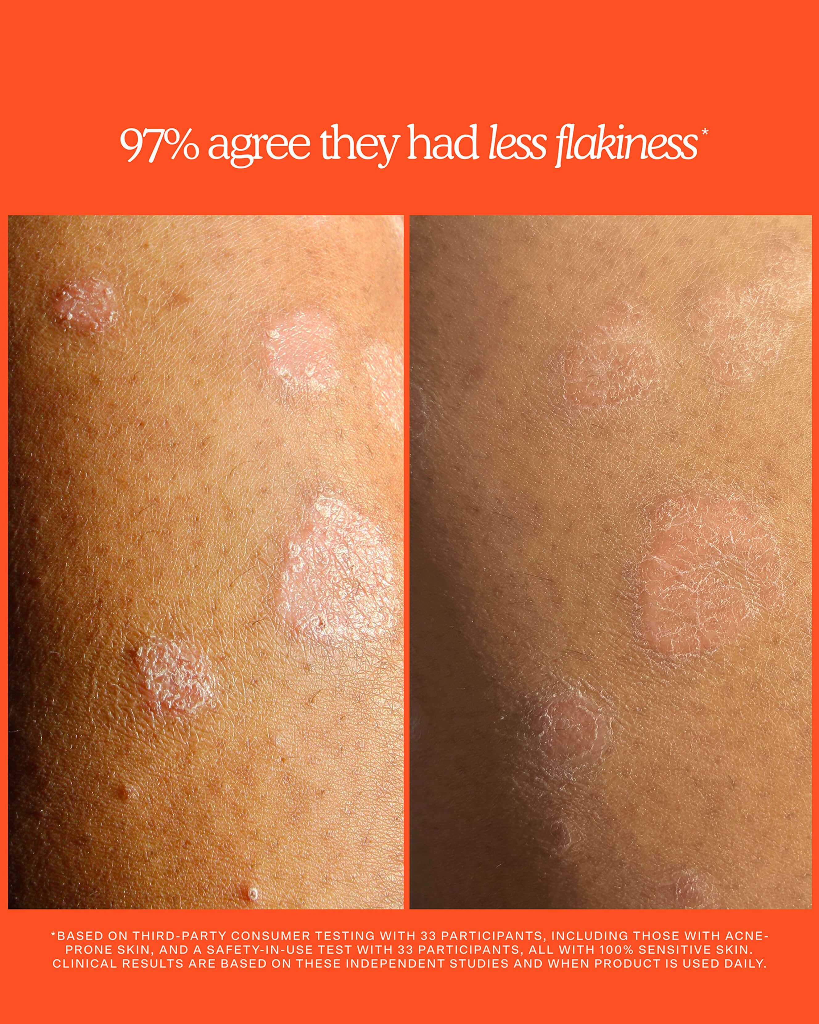 SOS Rescue + Relief Body Wash Treatment 8