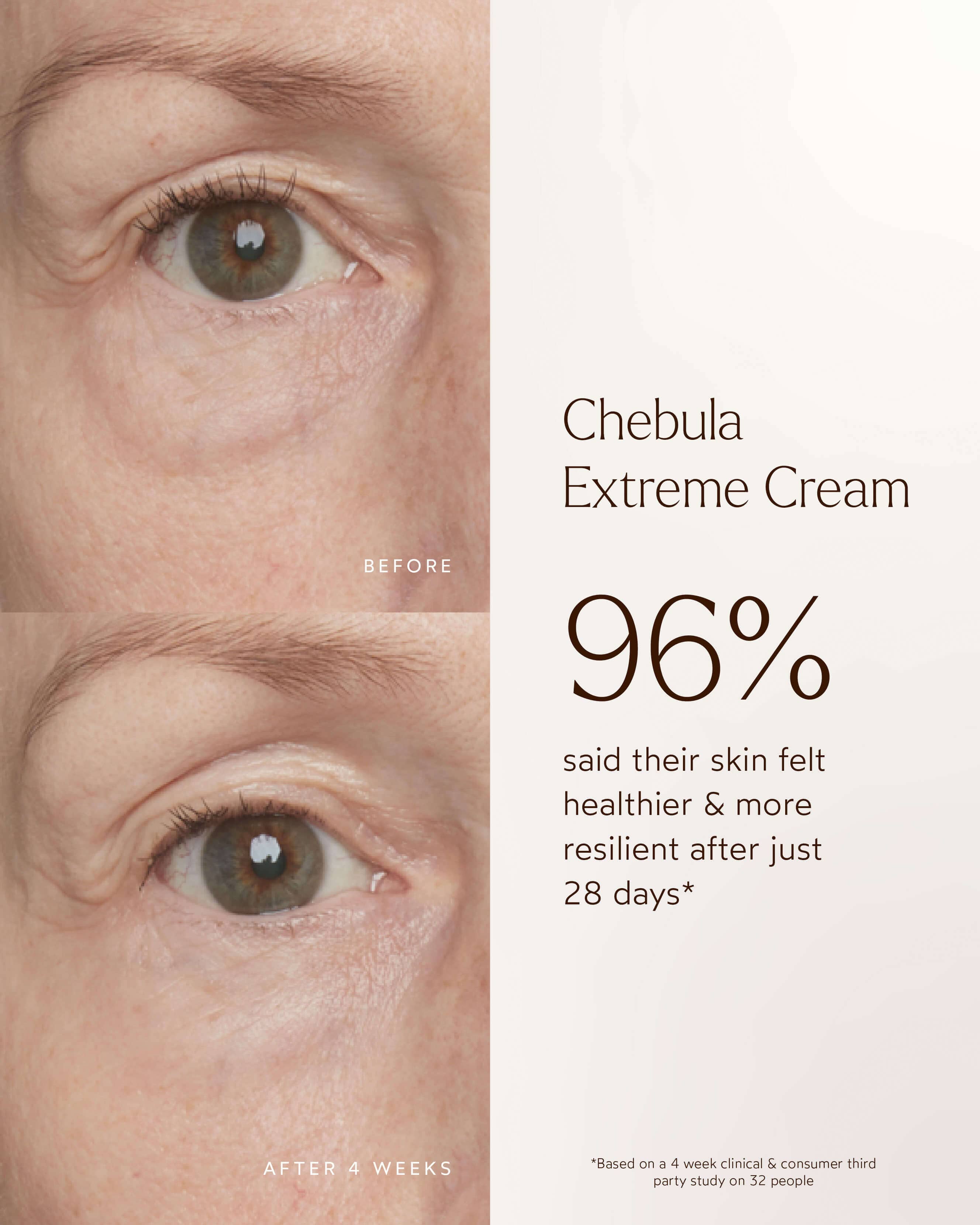 Chebula Extreme Cream 11