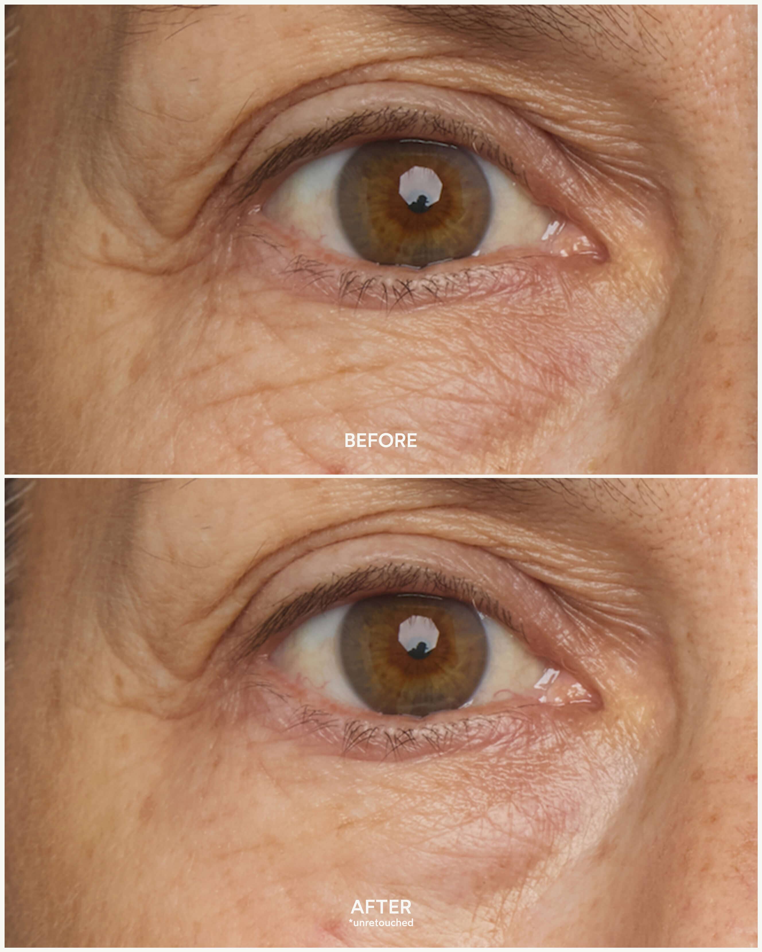 Chebula Multi-Corrective Eye Patches 7