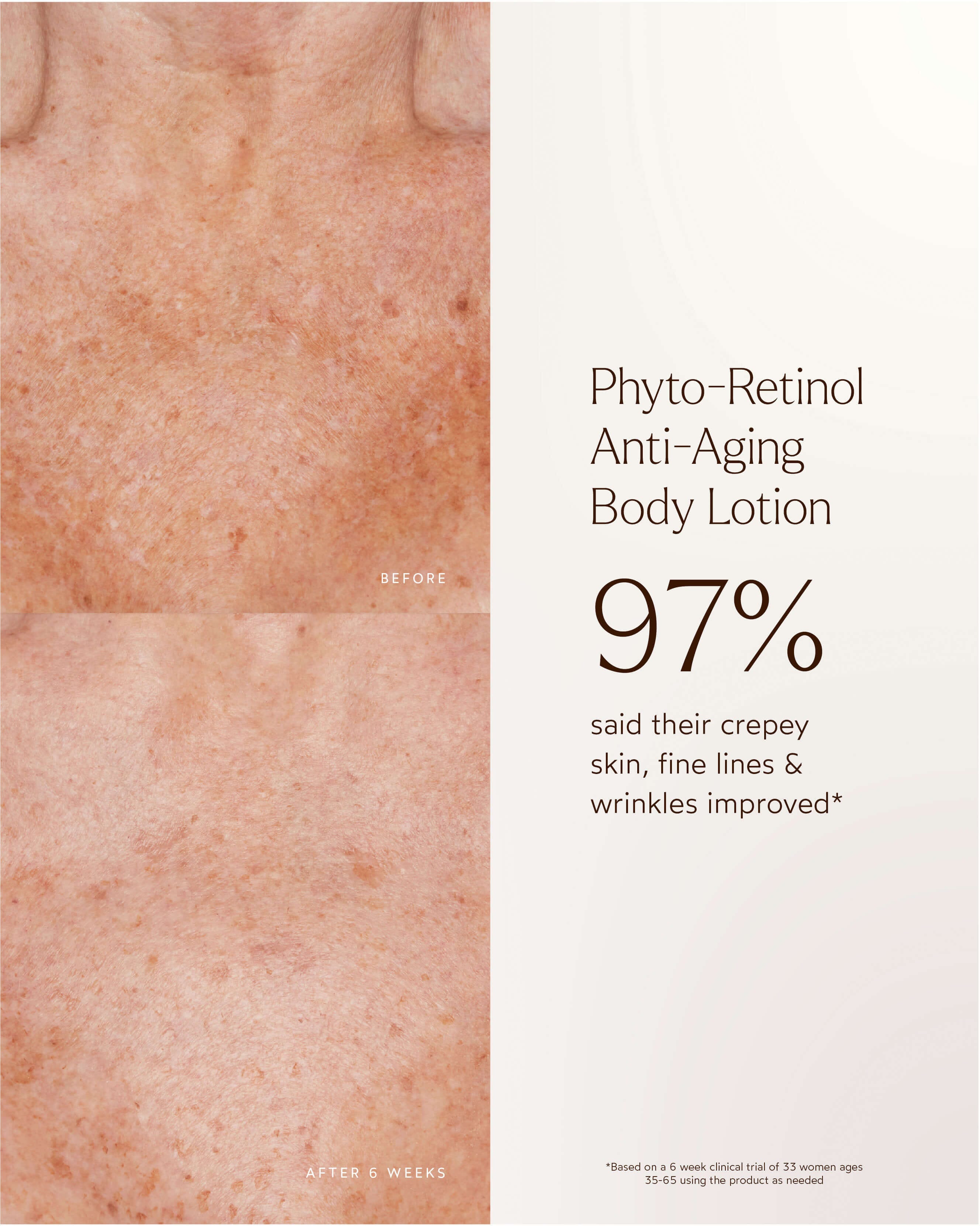 Phyto-Retinol Anti-Aging Body Lotion 7