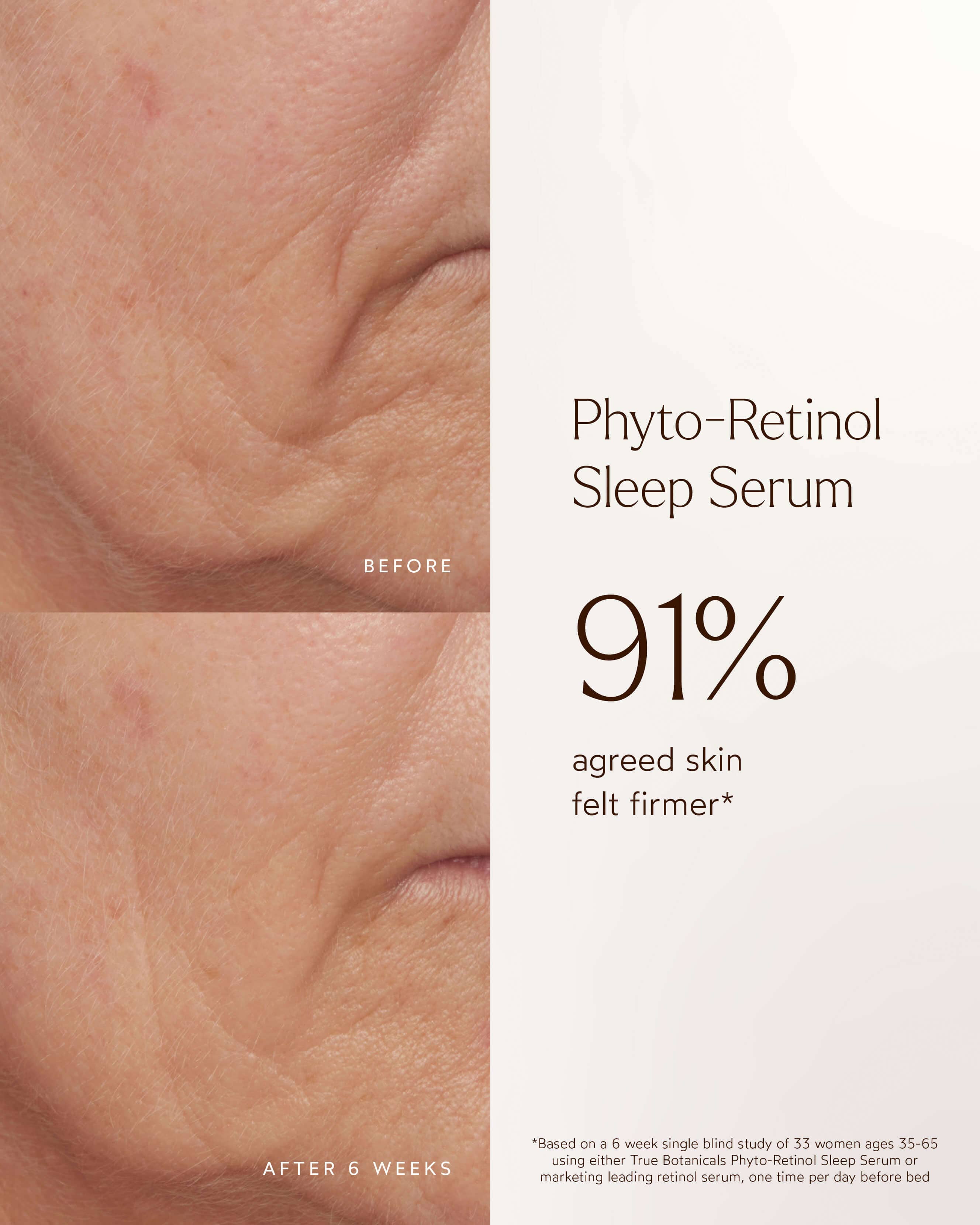 Phyto-Retinol Clinical Serum 8