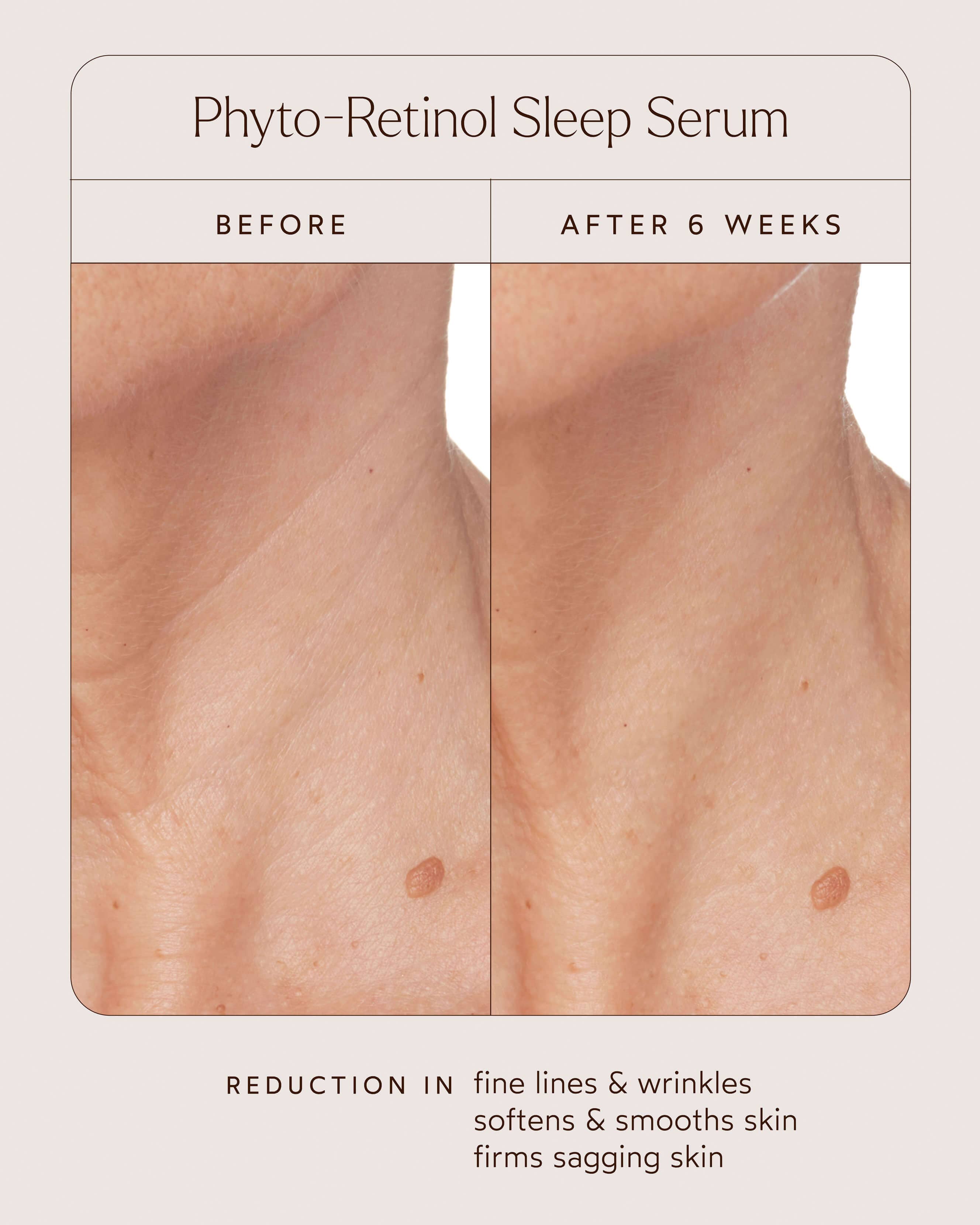 Phyto-Retinol Clinical Serum 3