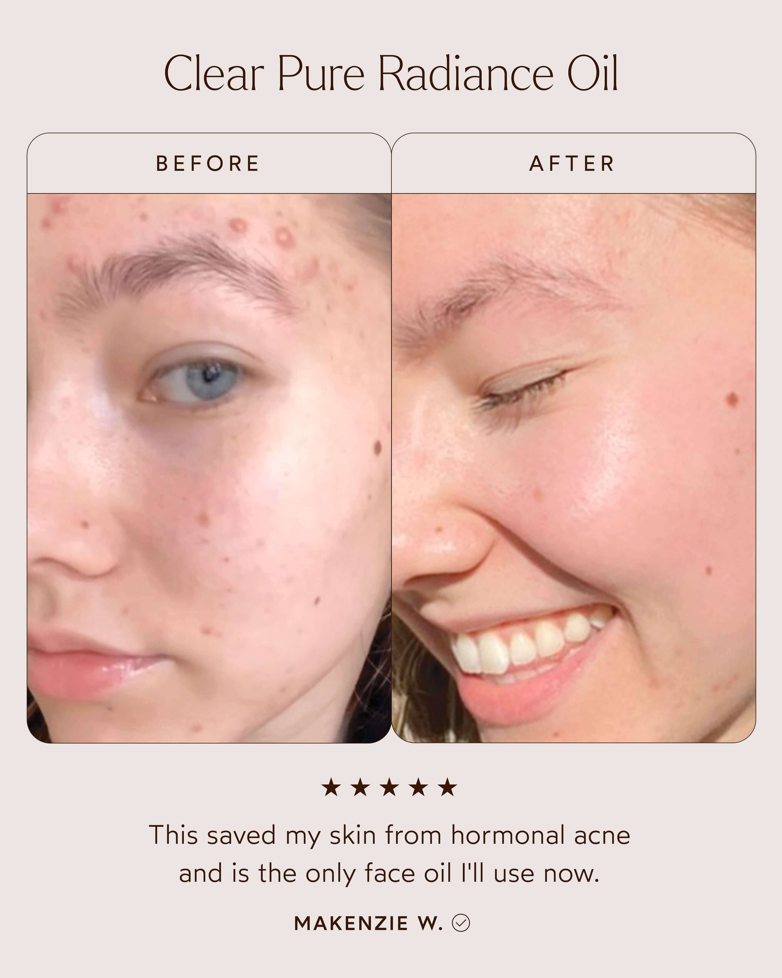 Pure Radiance Oil 5