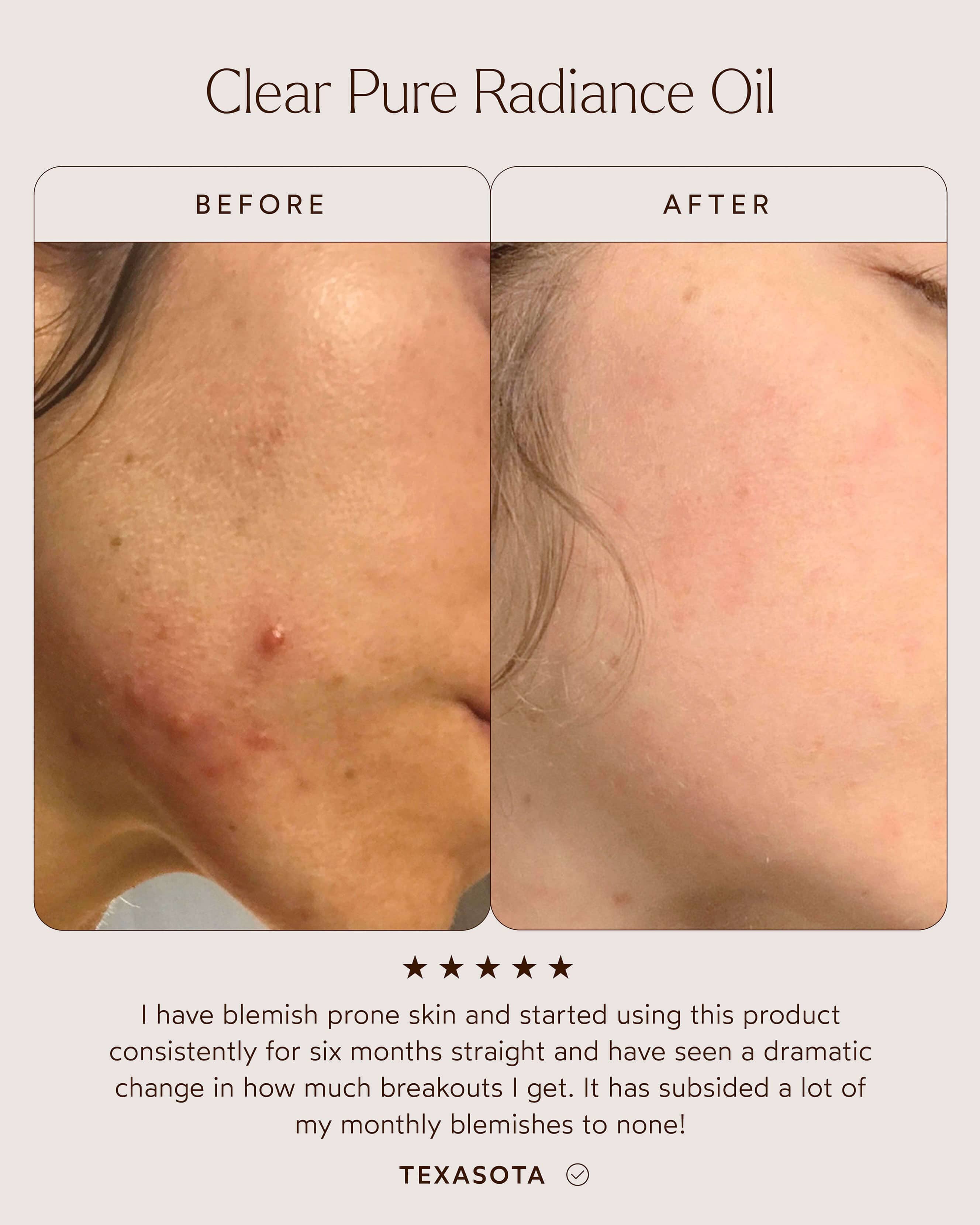 Pure Radiance Oil 6