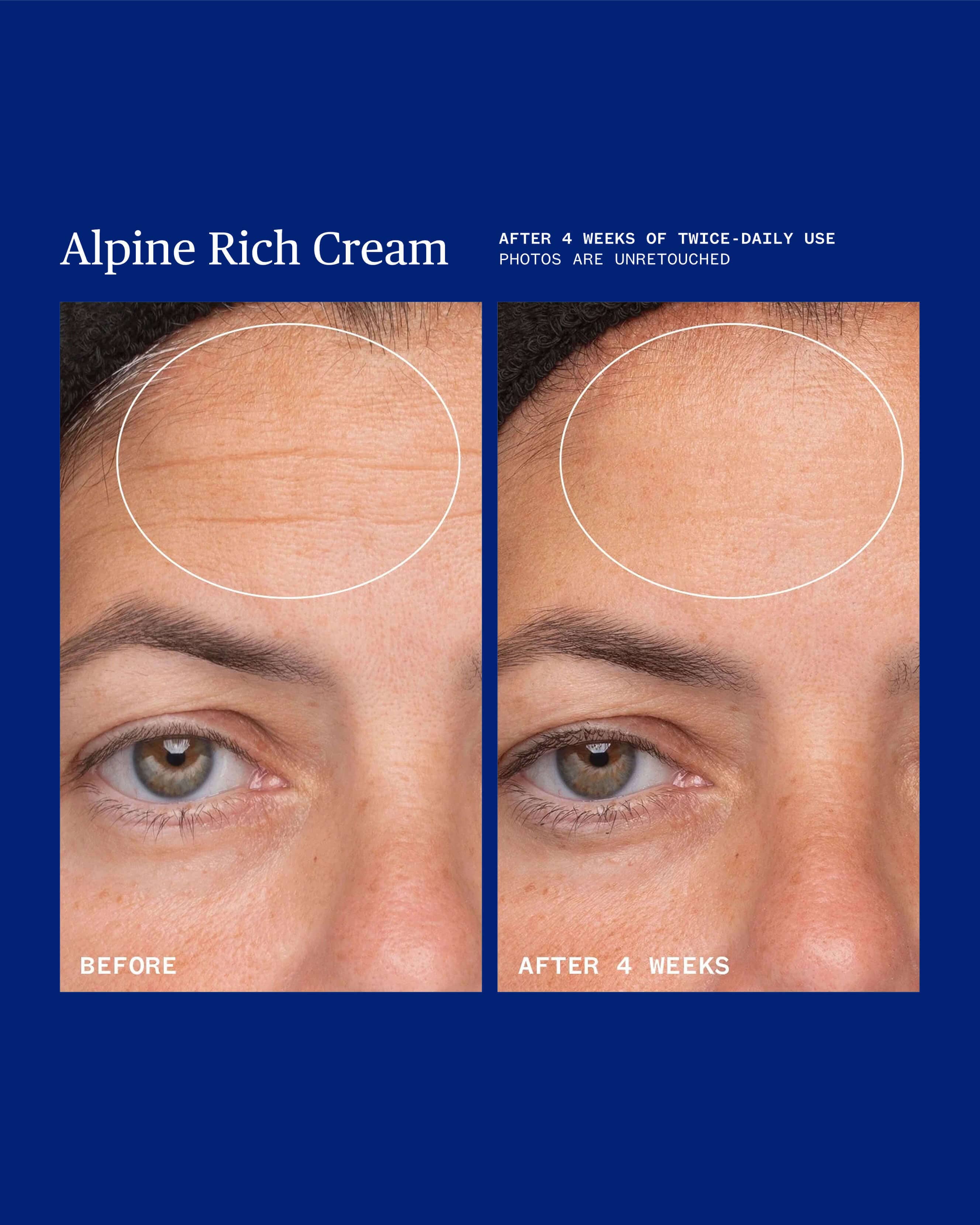 Alpine Rich Cream | Dry Skin's Dream Come True
– Ursa Major Skincare 2