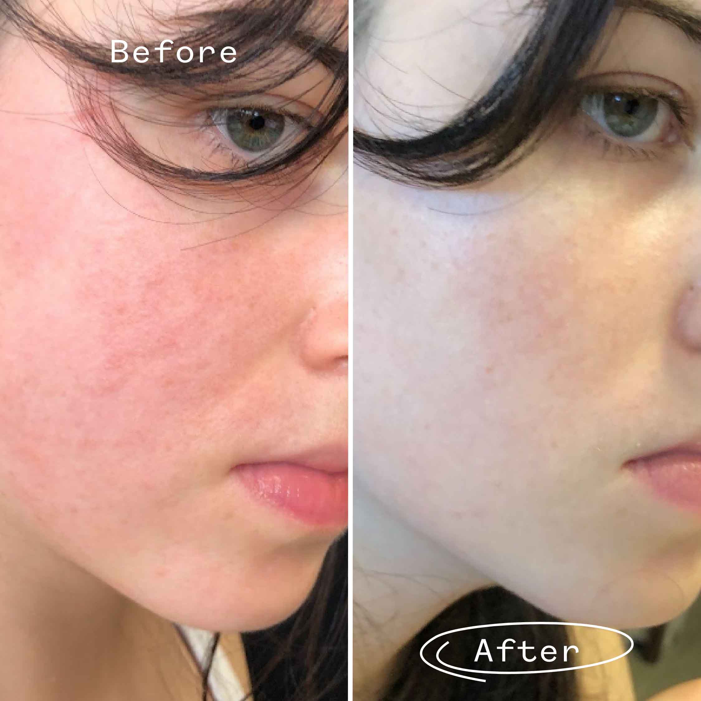 The Light Fantastic™ Face Oil Mini 2