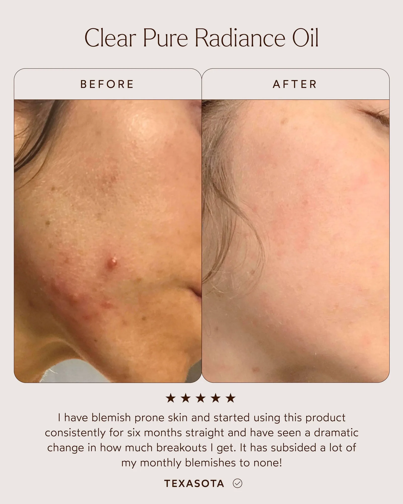 Pure Radiance Oil 7