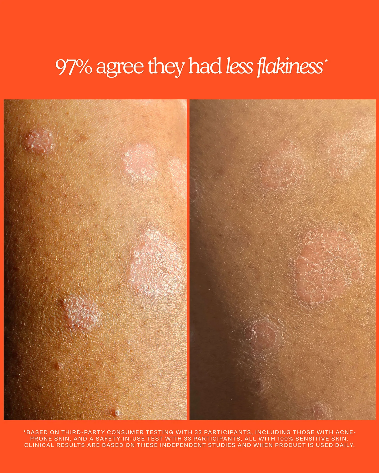 SOS Rescue + Relief Body Wash Treatment 9