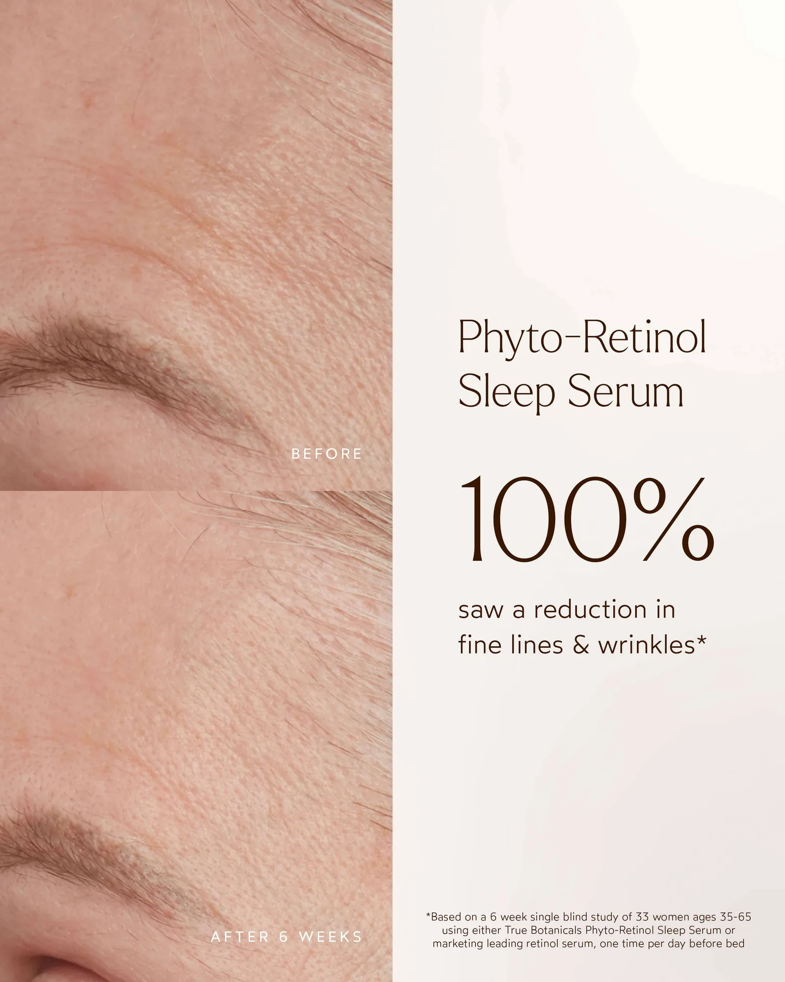 Phyto-Retinol Clinical Serum 10