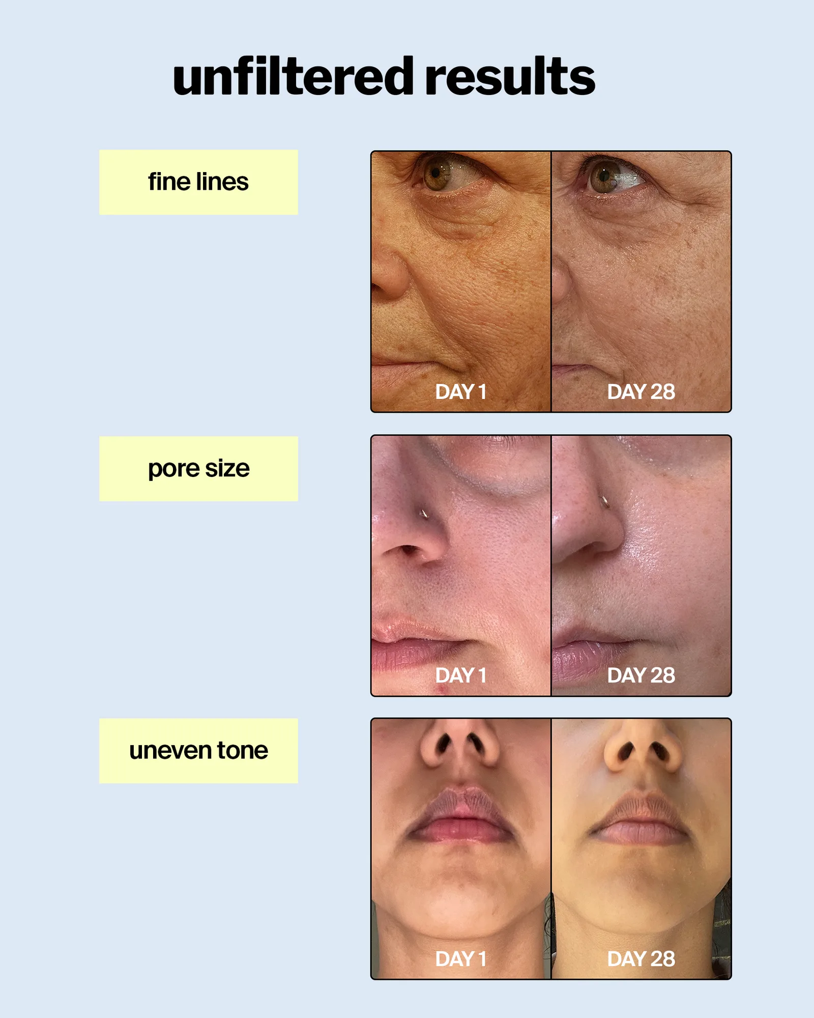 advanced retinol gel 0.5% 3