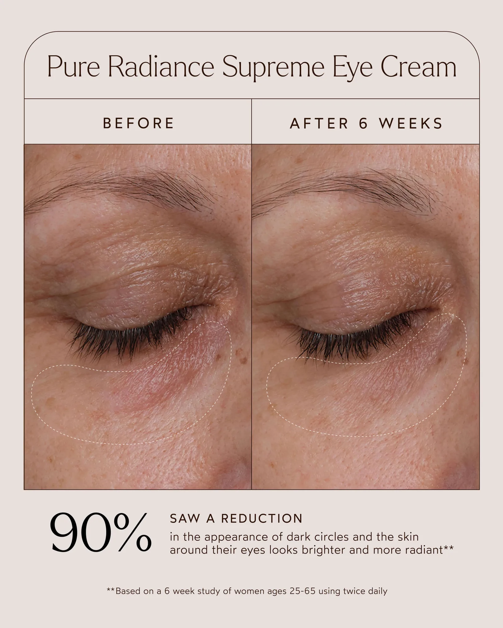 Pure Radiance Supreme Eye Cream 10