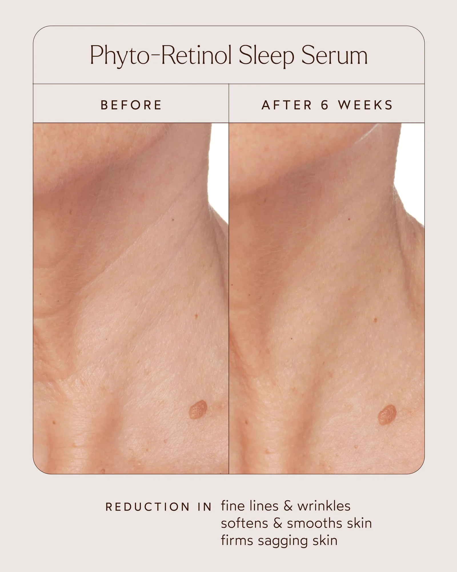 Phyto-Retinol Clinical Serum 4