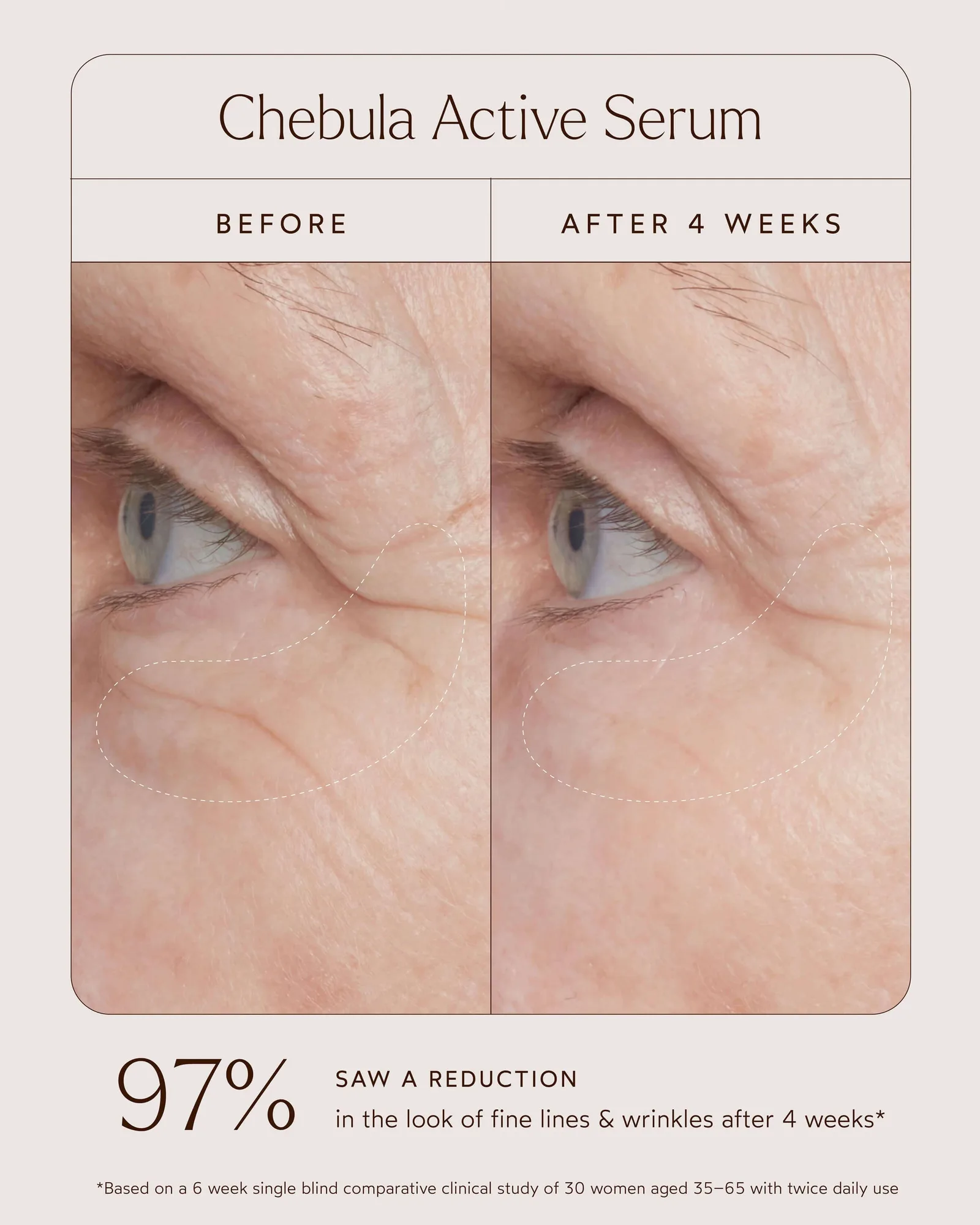 Chebula Active Serum 6