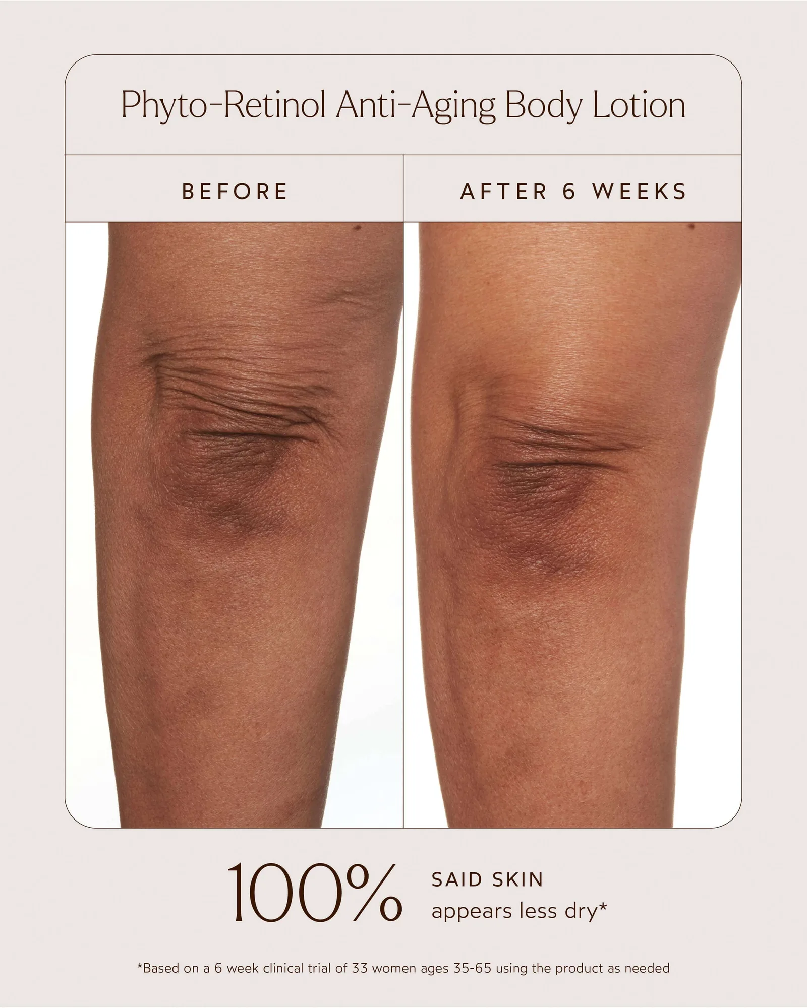Phyto-Retinol Anti-Aging Body Lotion 10