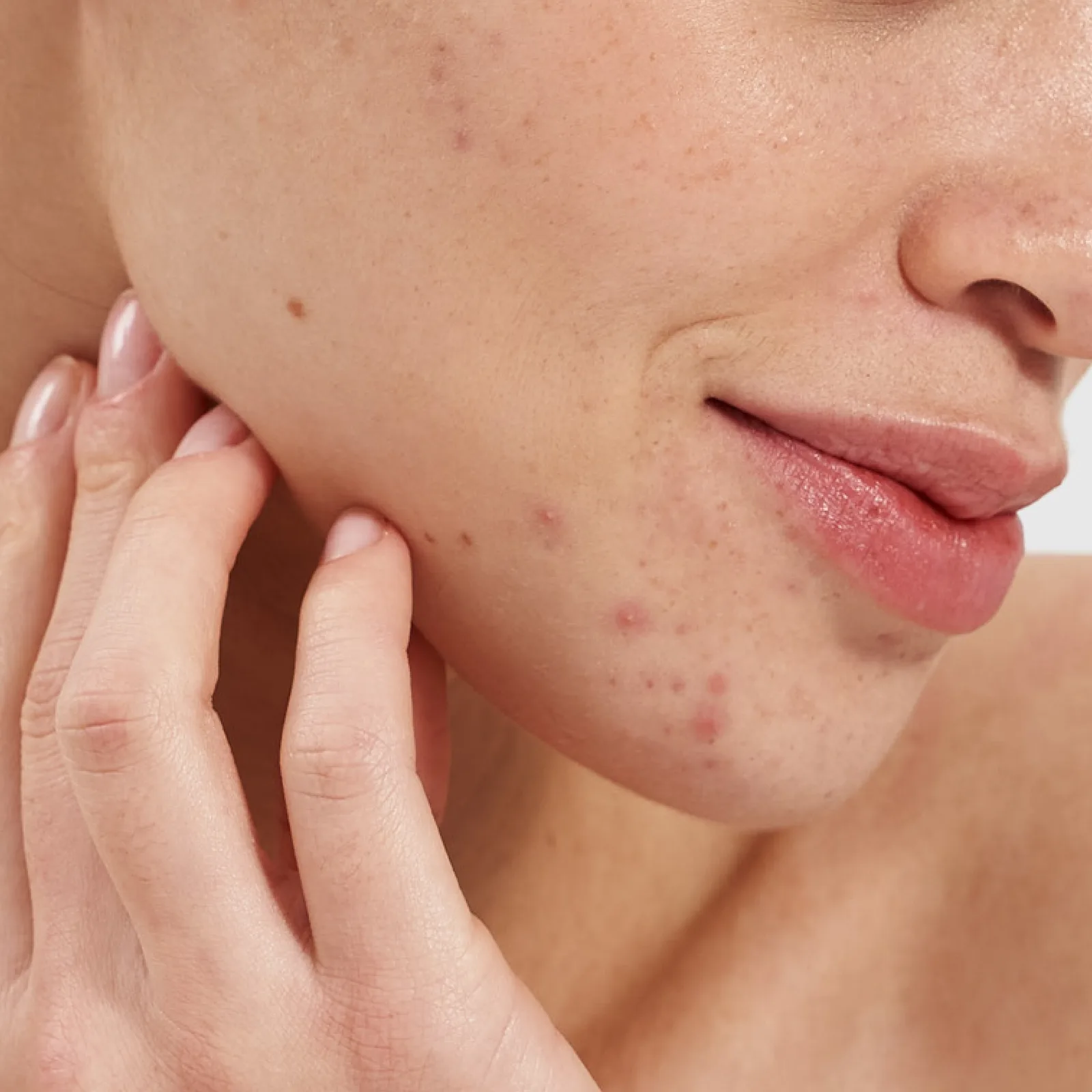 Salicylic Acid 2% Clarifying Booster 4