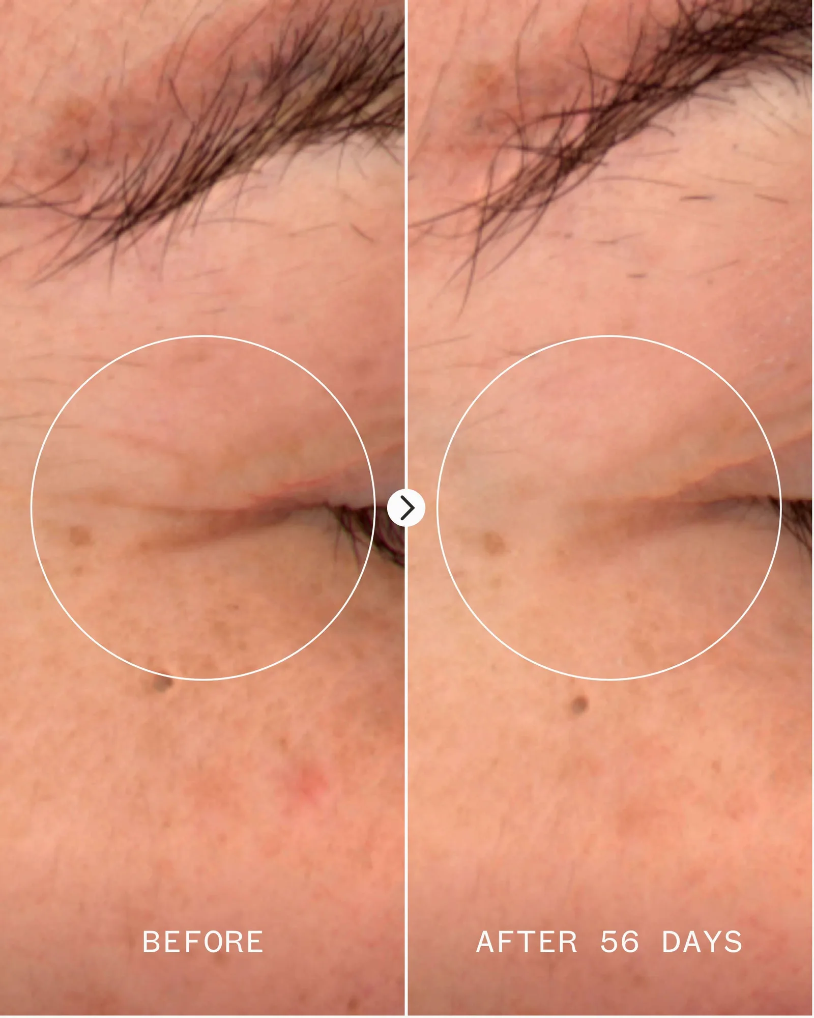 Age Confidence™ NAD+ & TriPeptide Renewal Serum 4