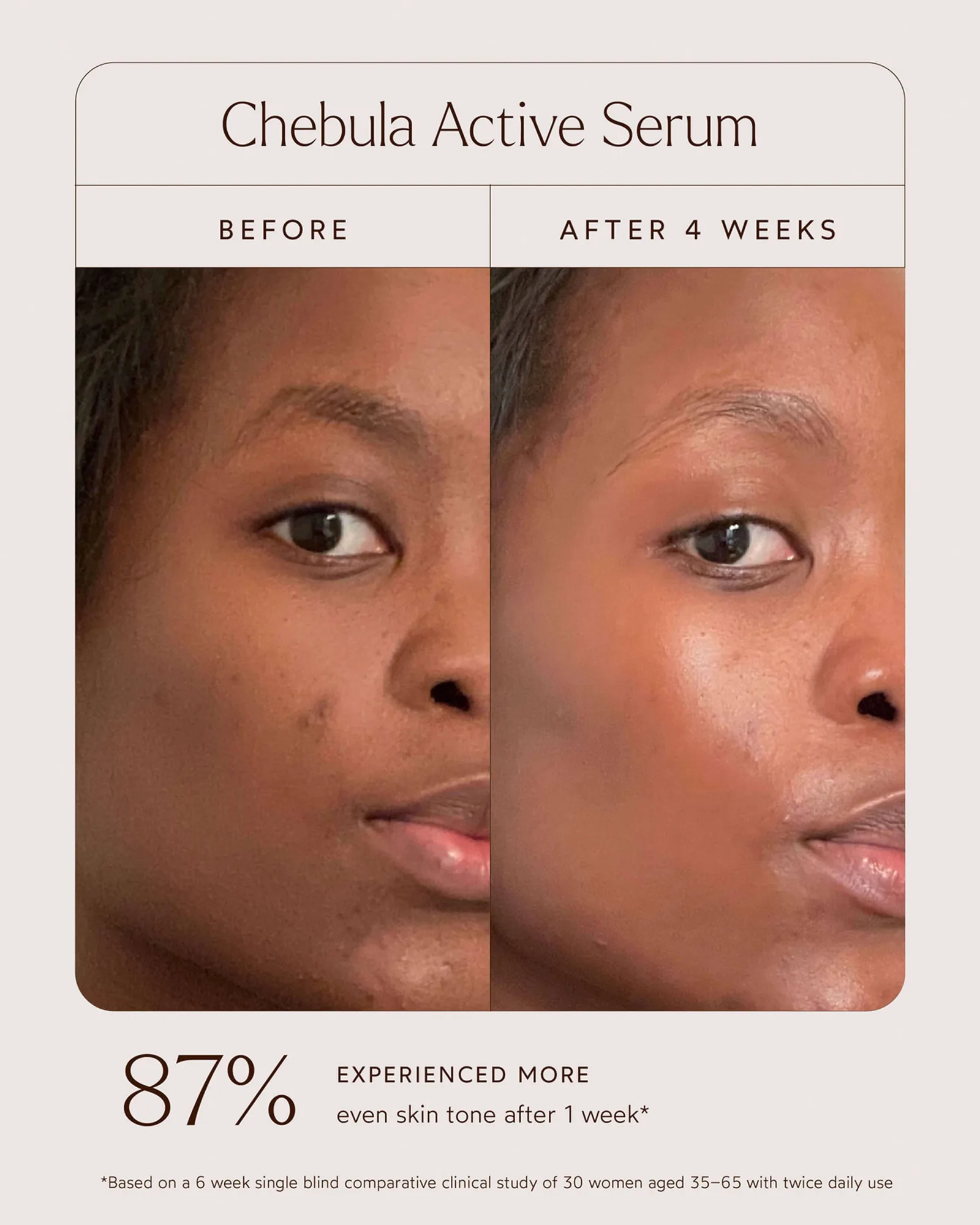 Chebula Active Serum 12