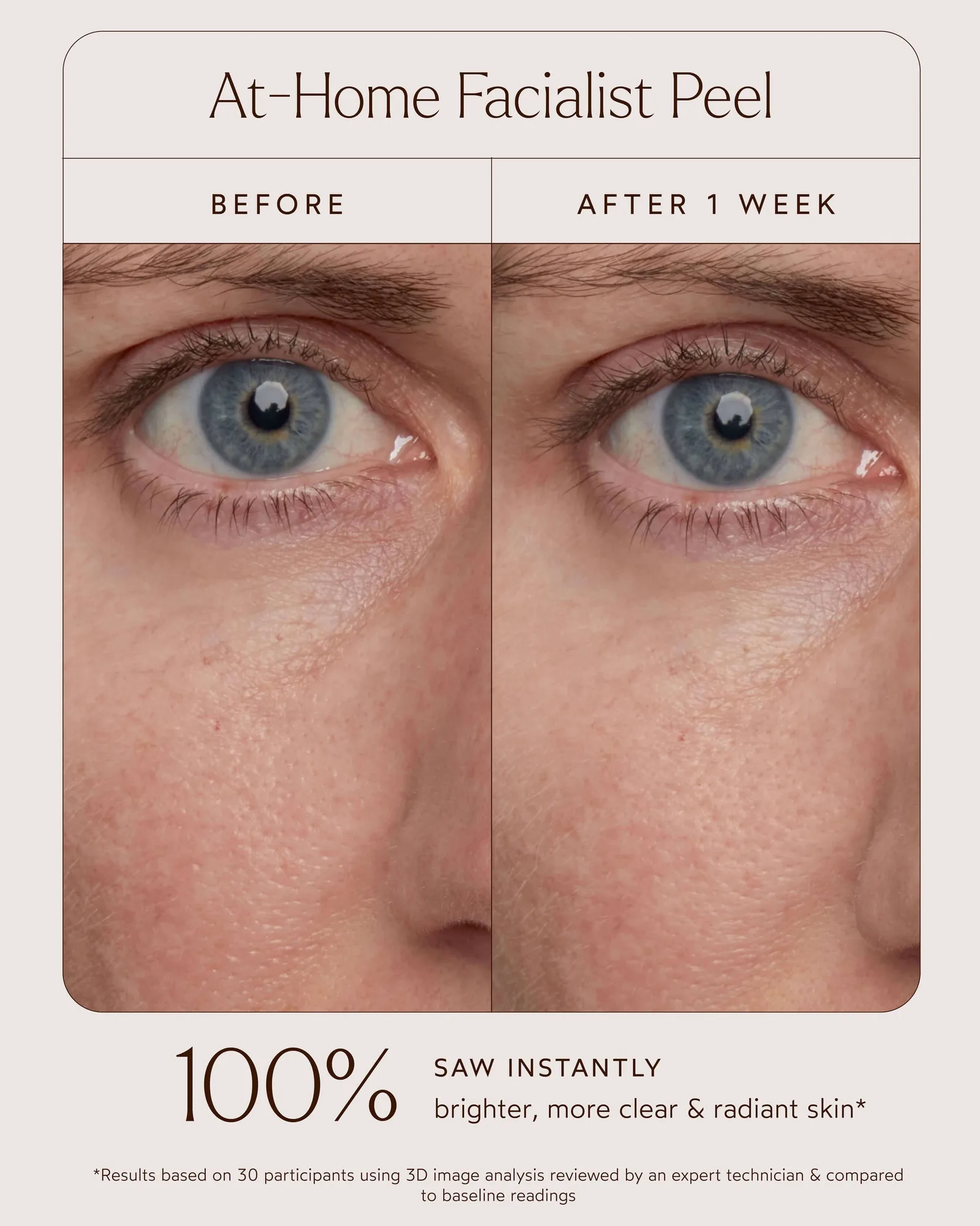 At-Home Facialist Peel 6