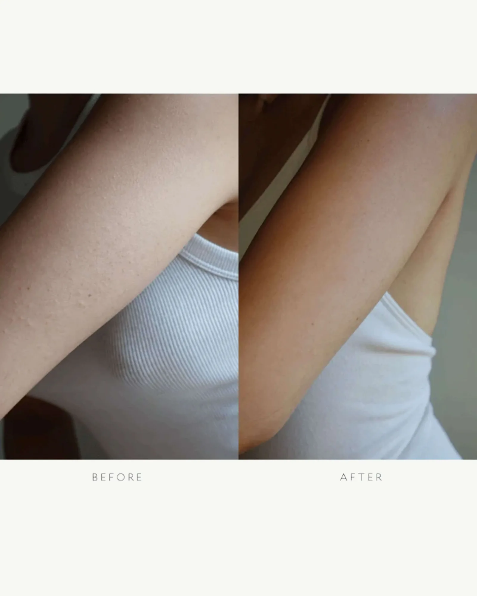 Resurfacing Body Serum - 25ml 6