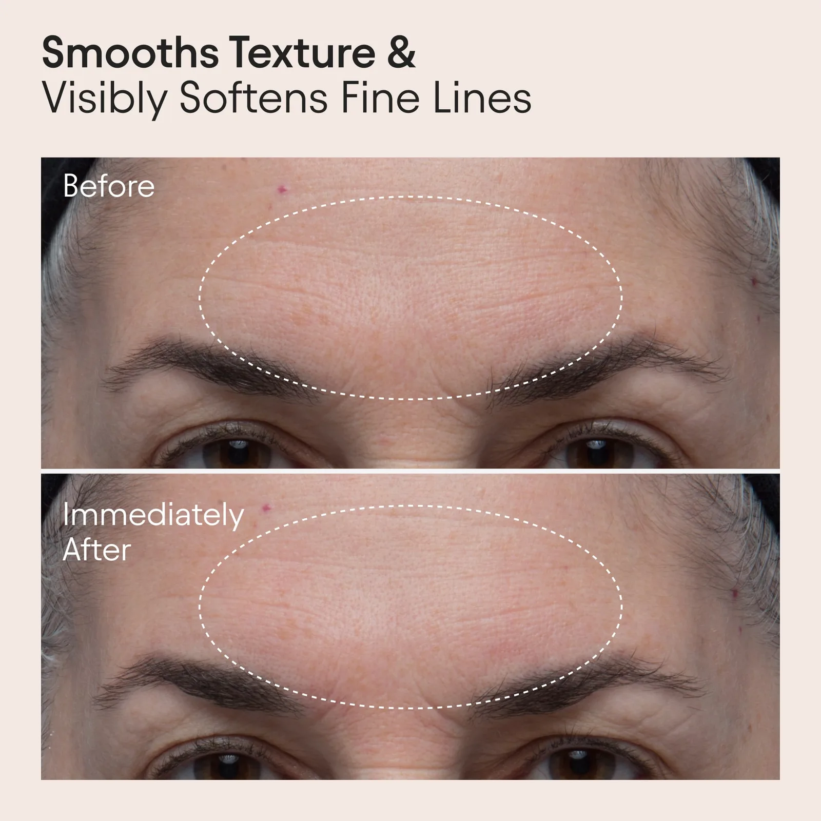 Double Polishing Peel 3