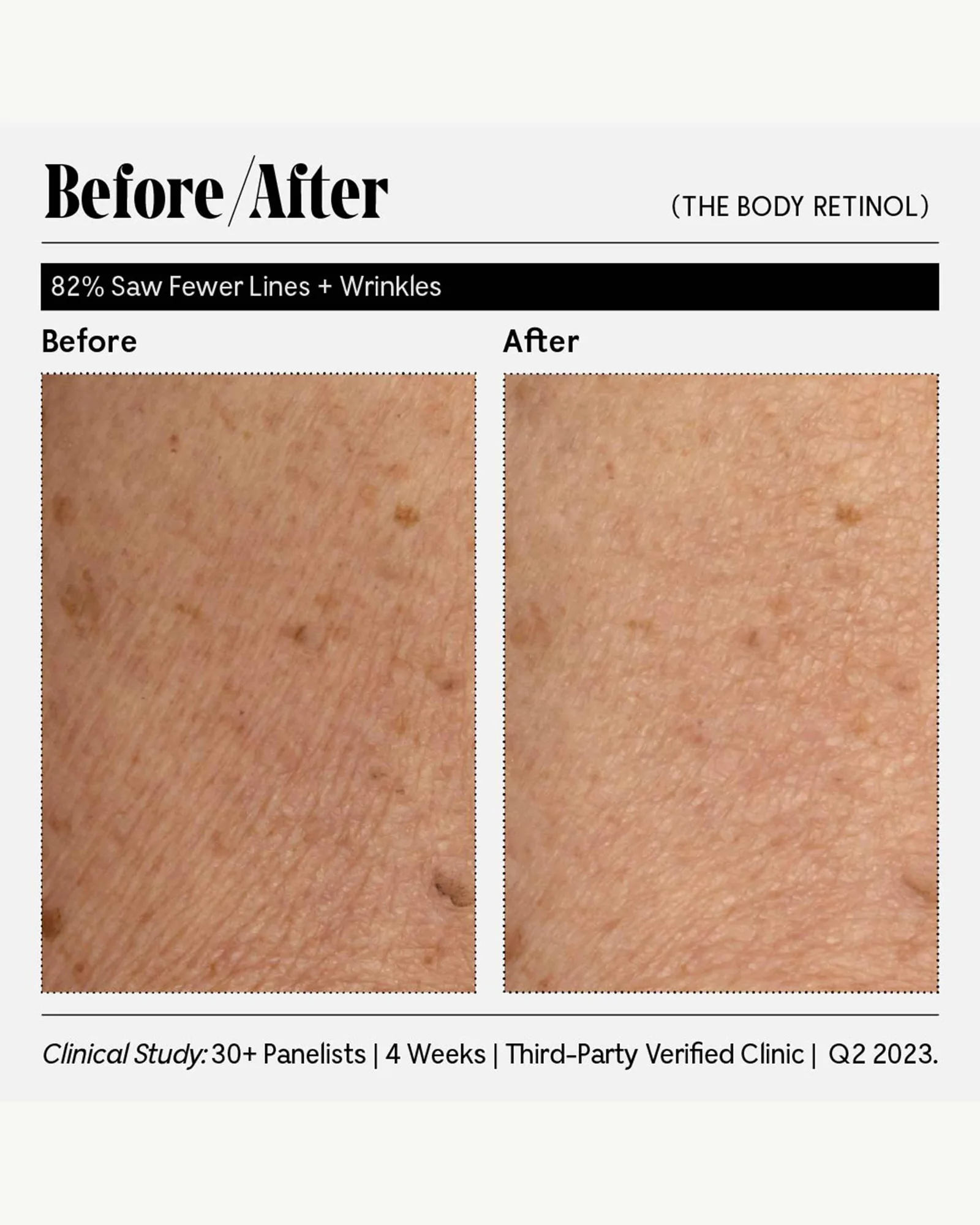 The Body Treatment Duo 4