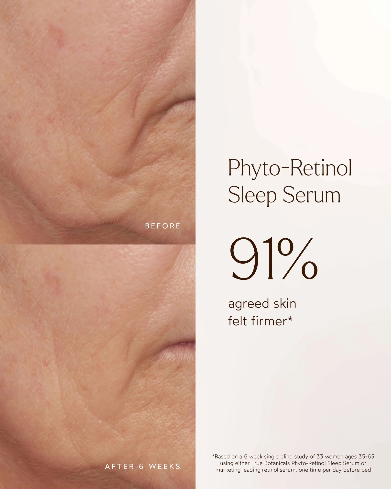 Phyto-Retinol Clinical Serum 9