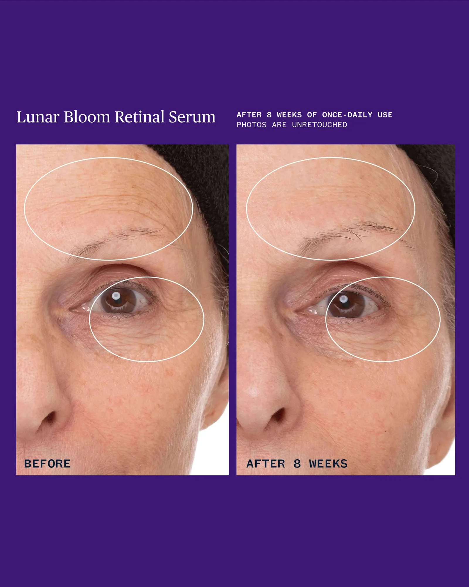 Lunar Bloom Retinal Serum 10