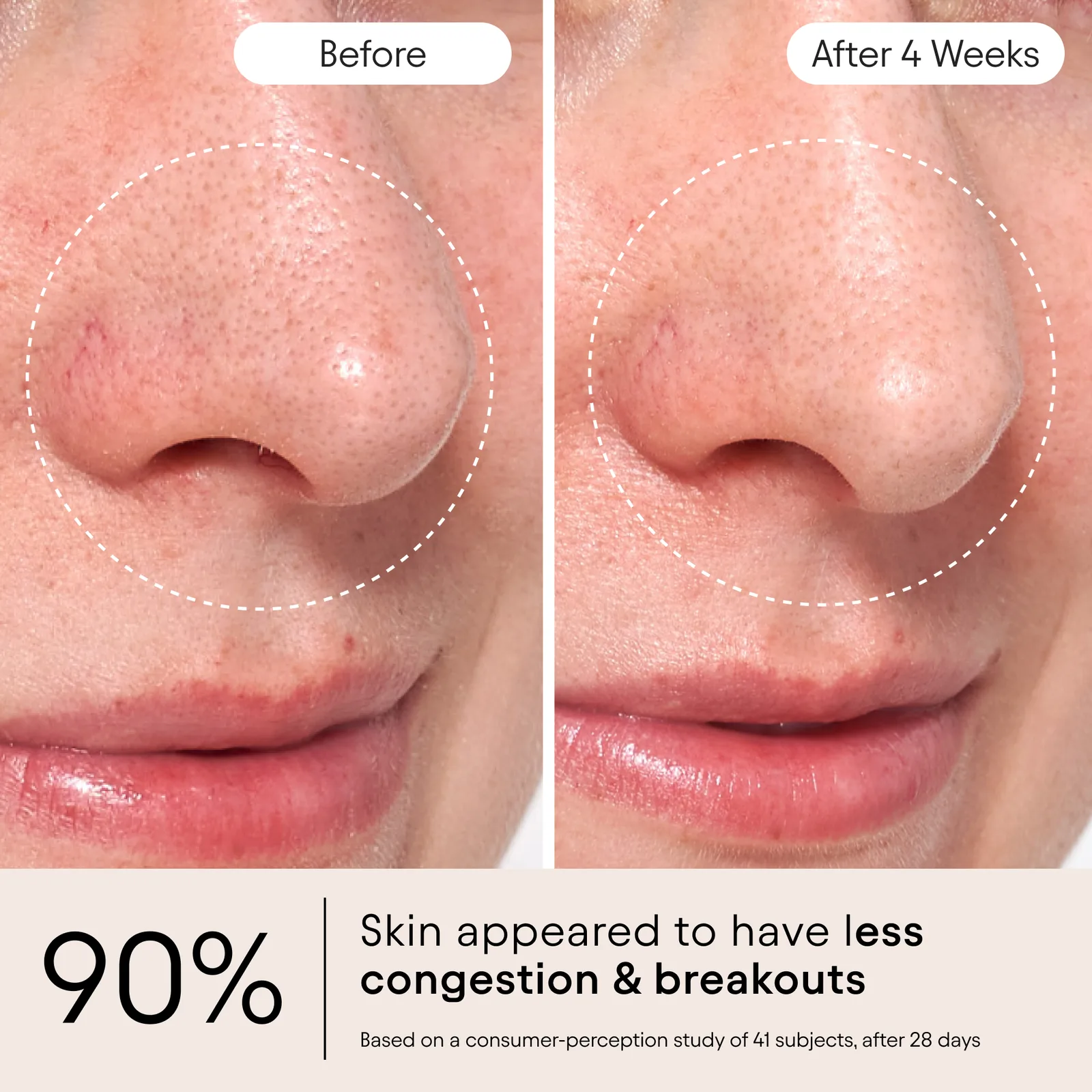 Clarifying Facial Oil 4