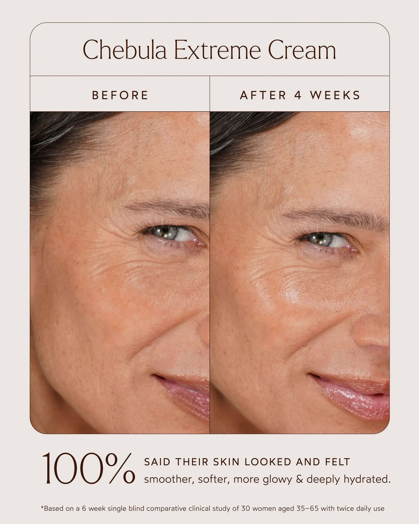 Chebula Extreme Cream 10
