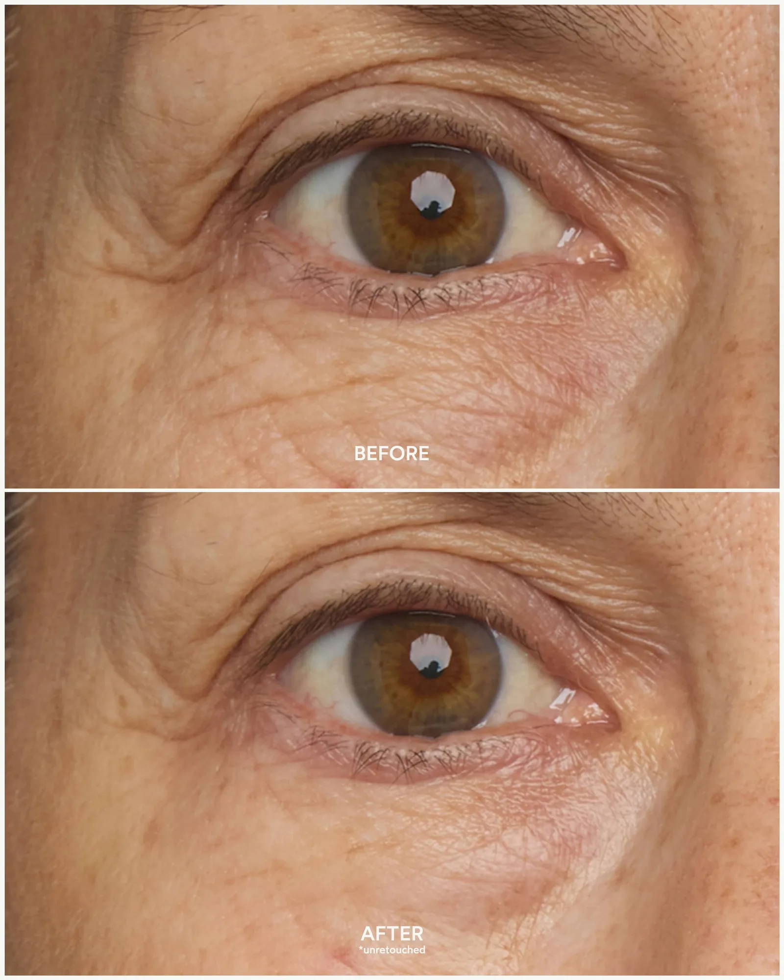 Chebula Multi-Corrective Eye Patches 8