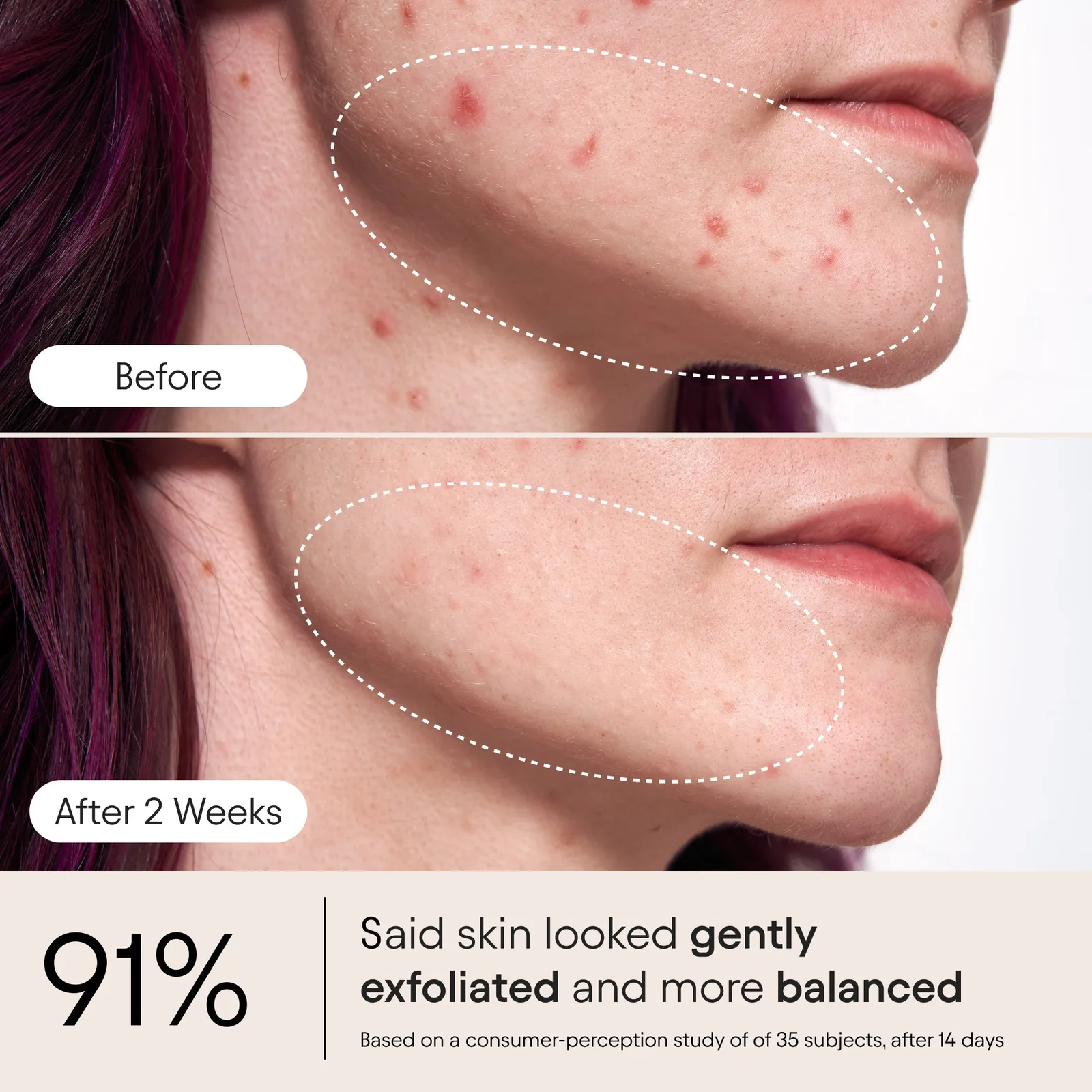 Pore Perfecting Liquid 3