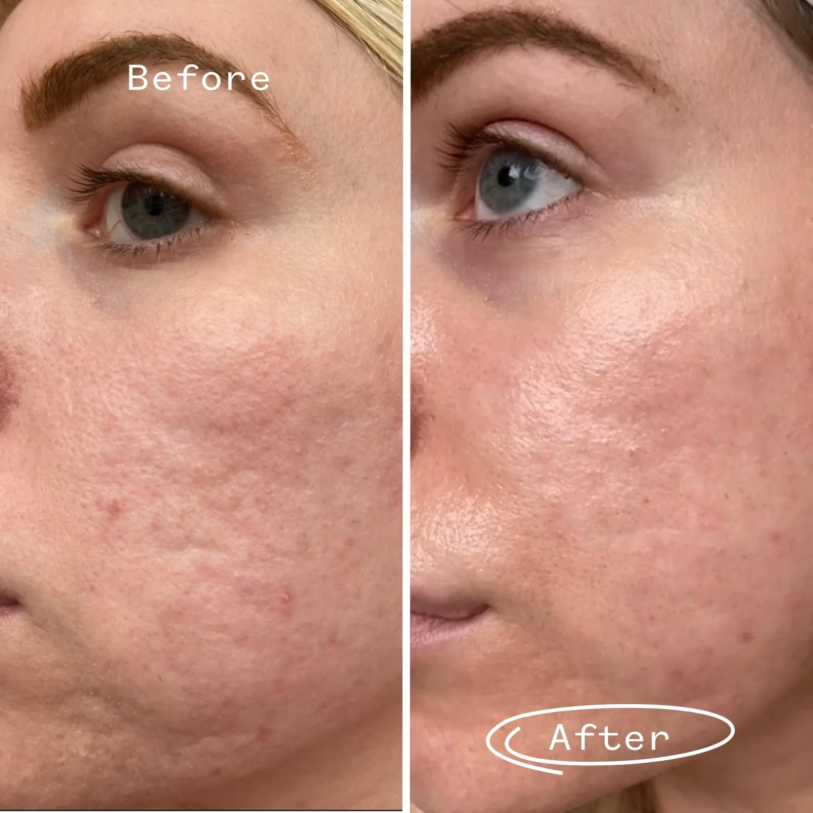 Hyaluronic Acid 0.3% Hydrating Booster 1