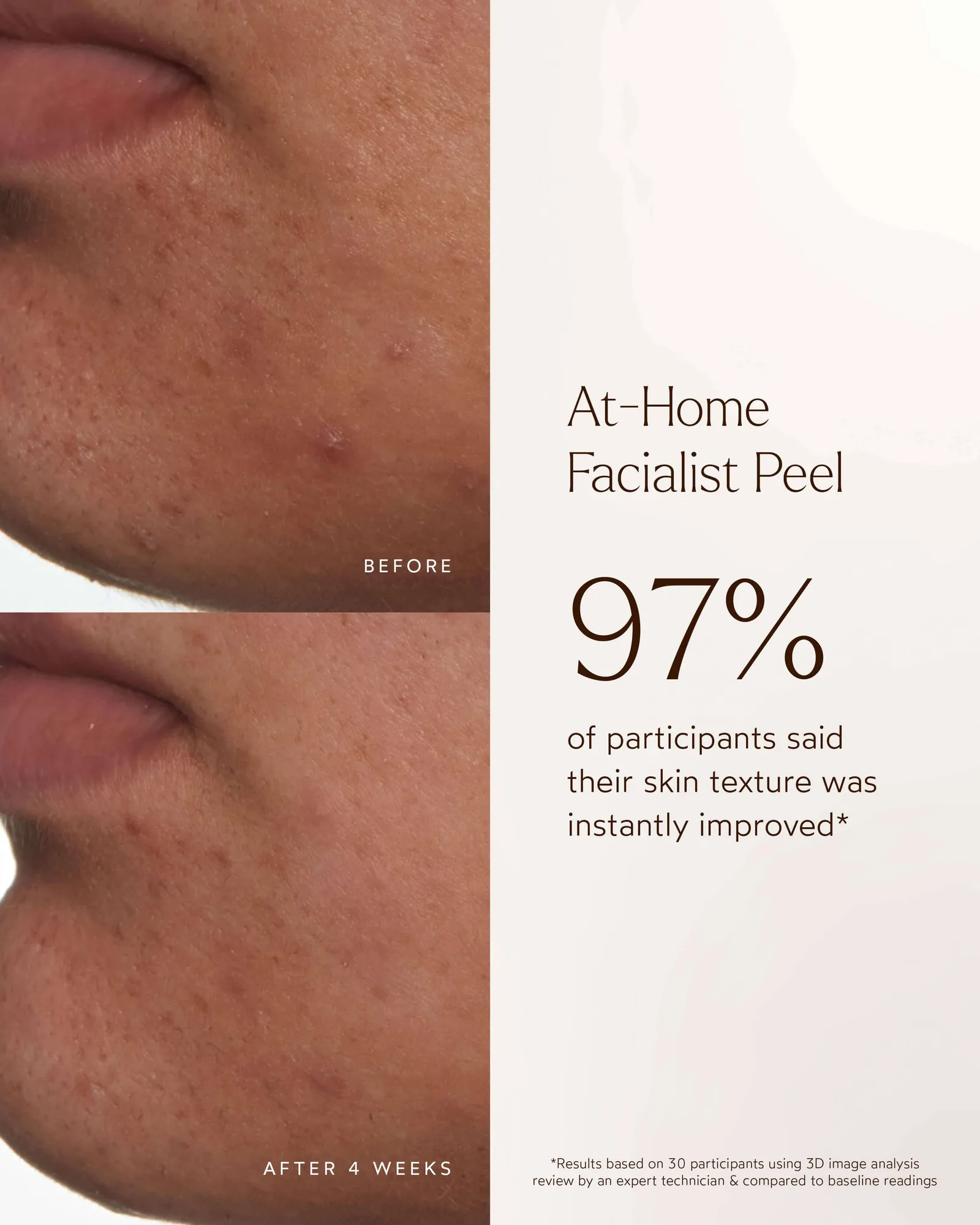 At-Home Facialist Peel 9