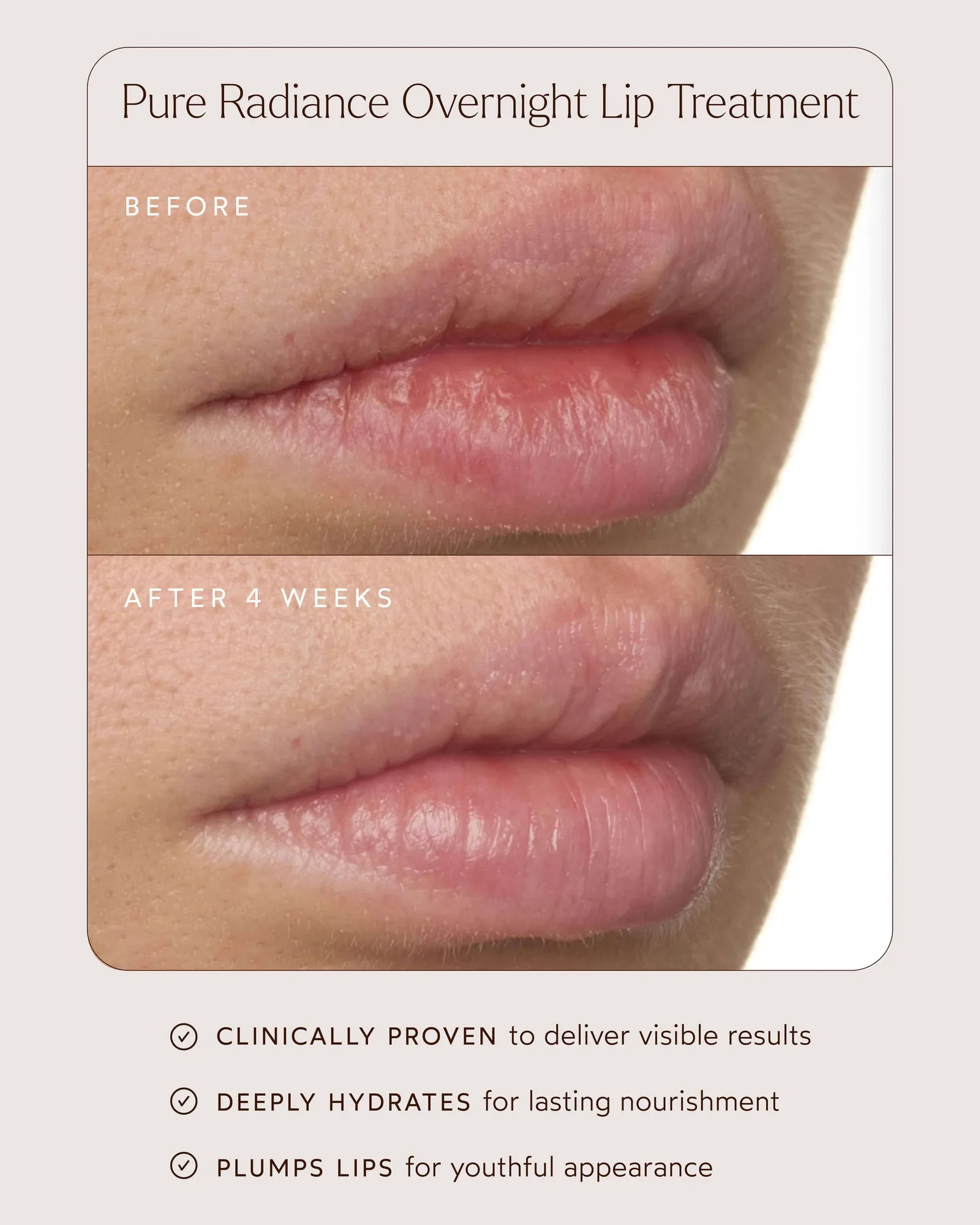 Pure Radiance Overnight Lip Treatment 5
