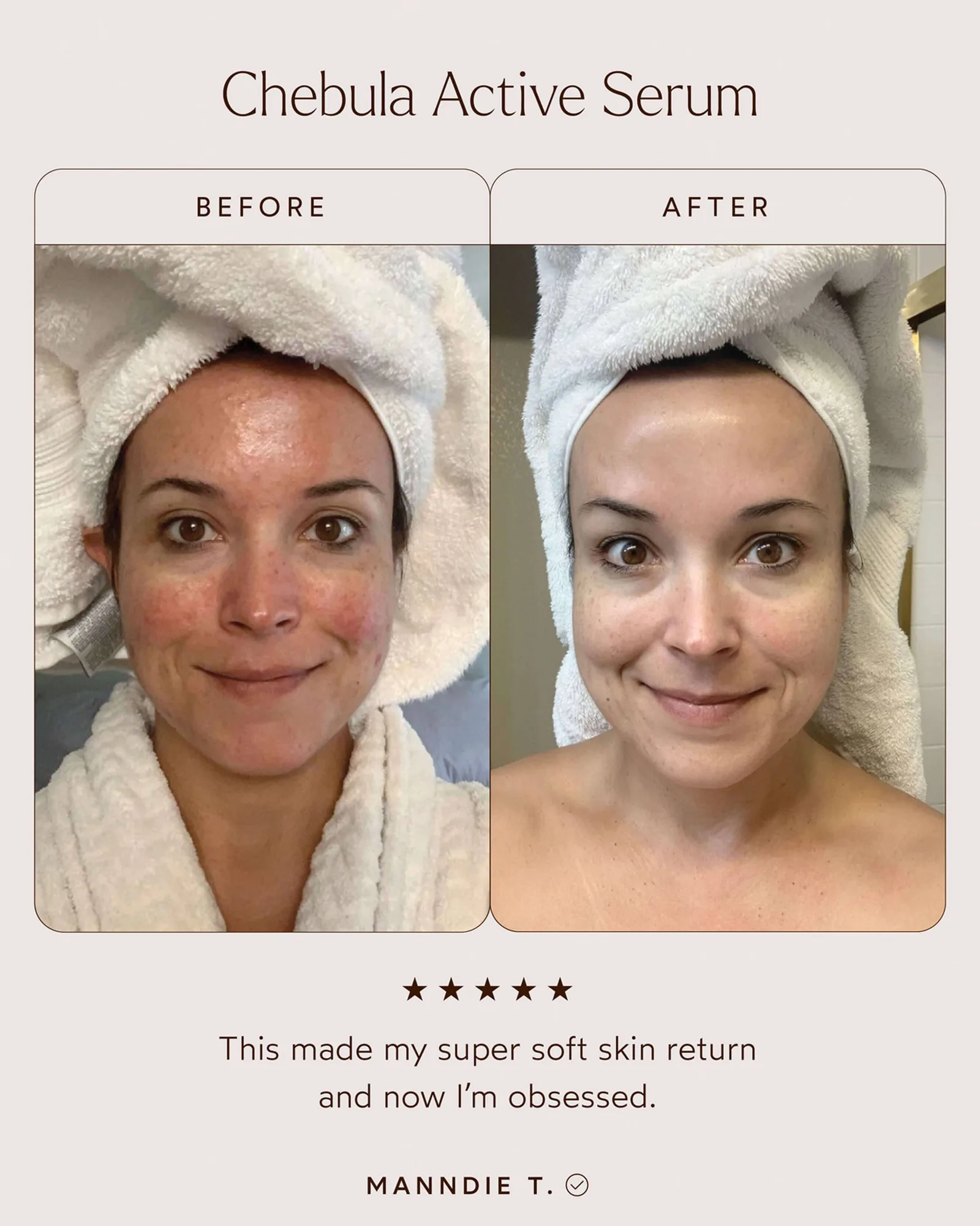 Chebula Active Serum 4