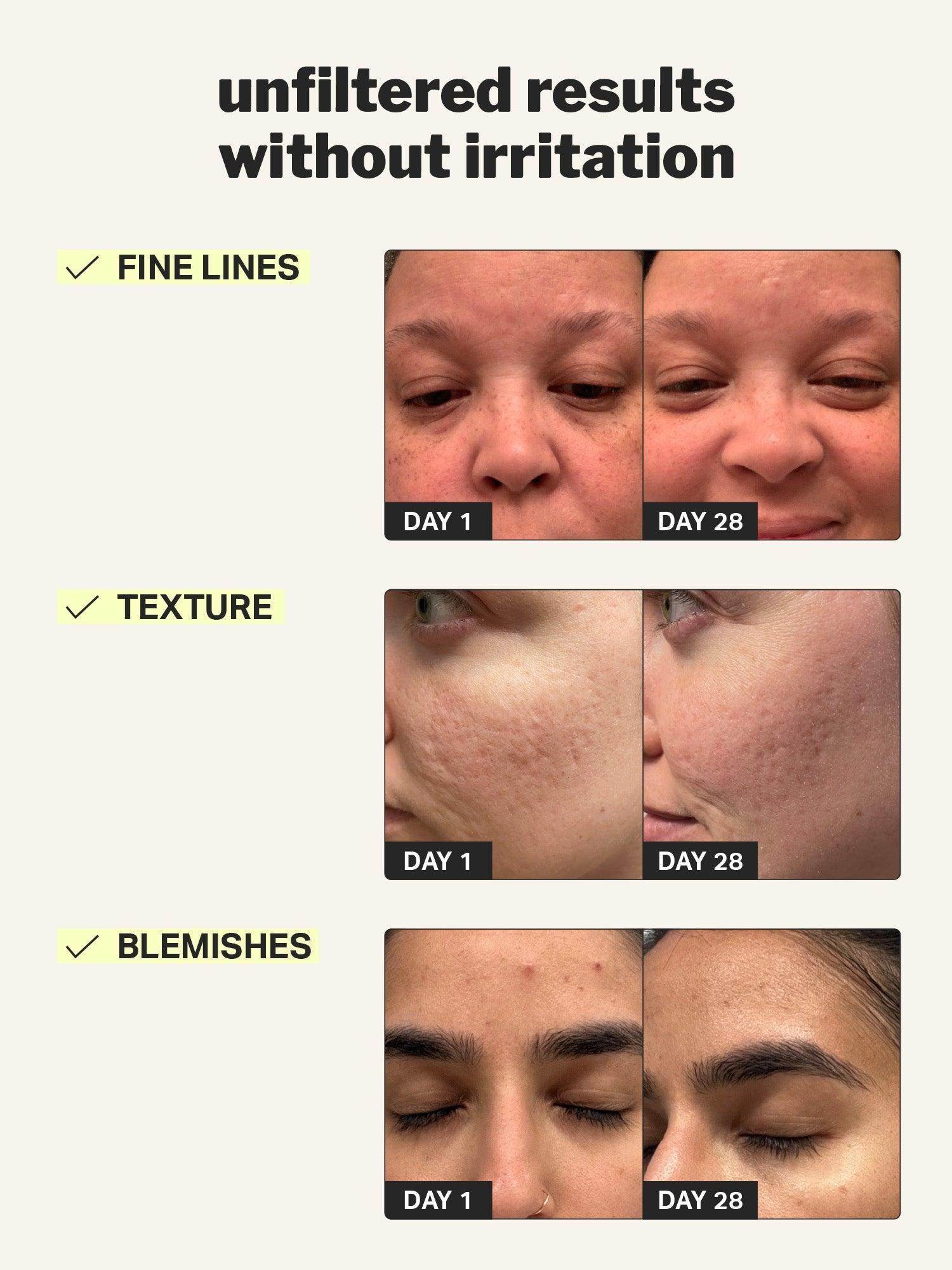 beginner retinol gel 0.1% 3