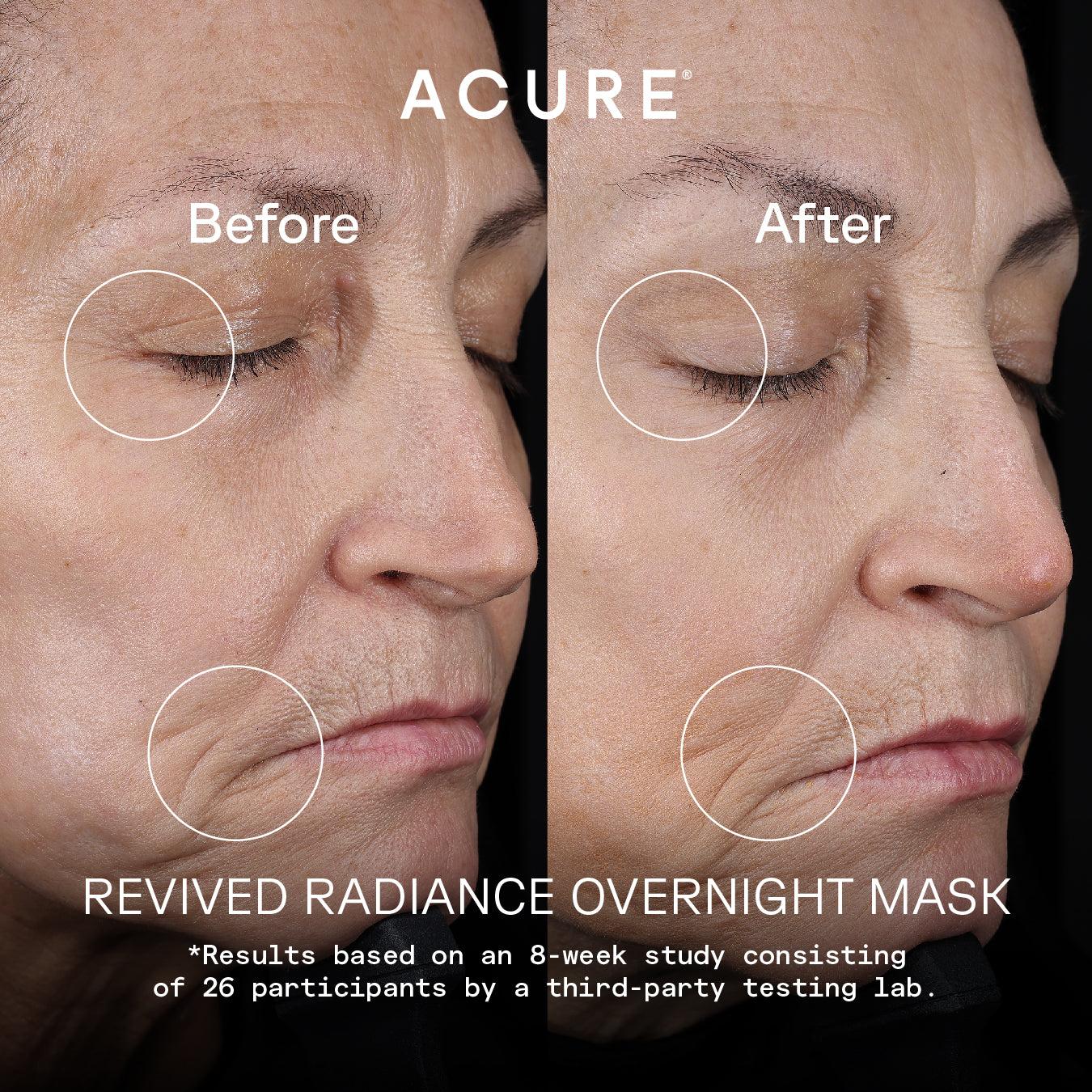 Overnight Renewal Duo 5