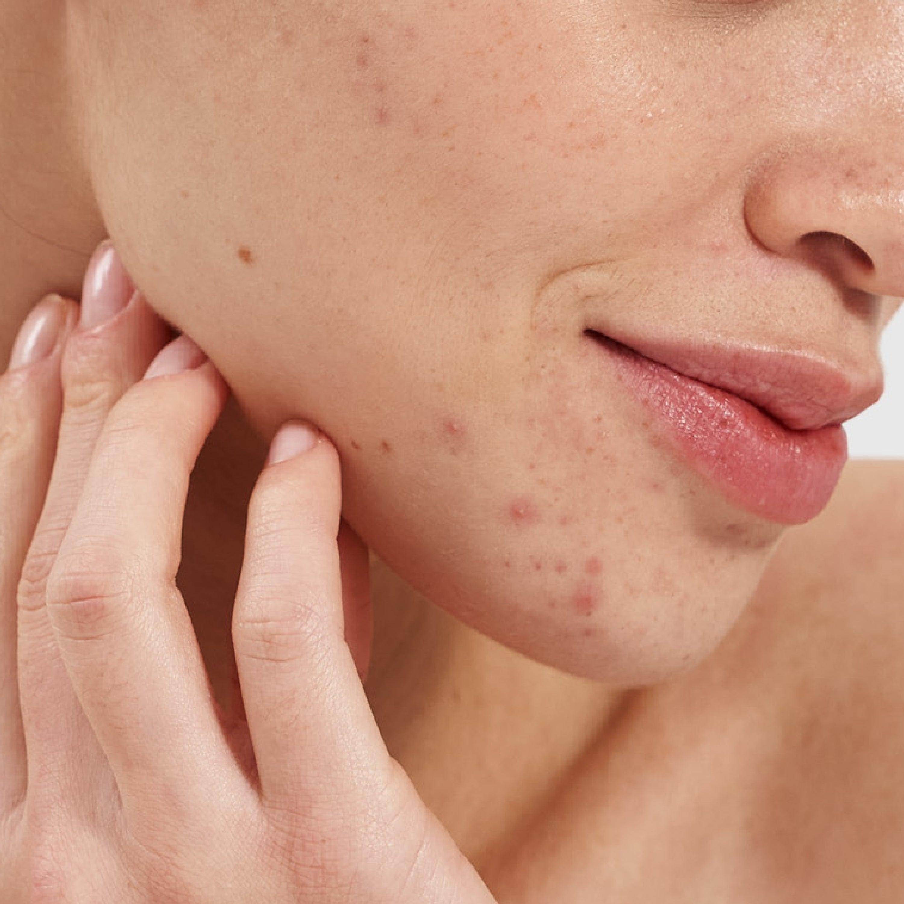 Salicylic Acid 2% Clarifying Booster 4