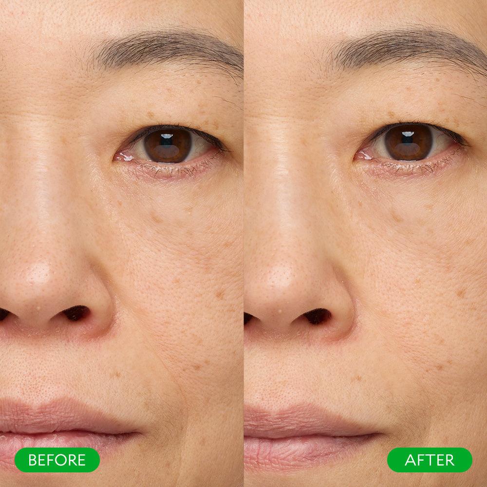 5 Minute Facial 5